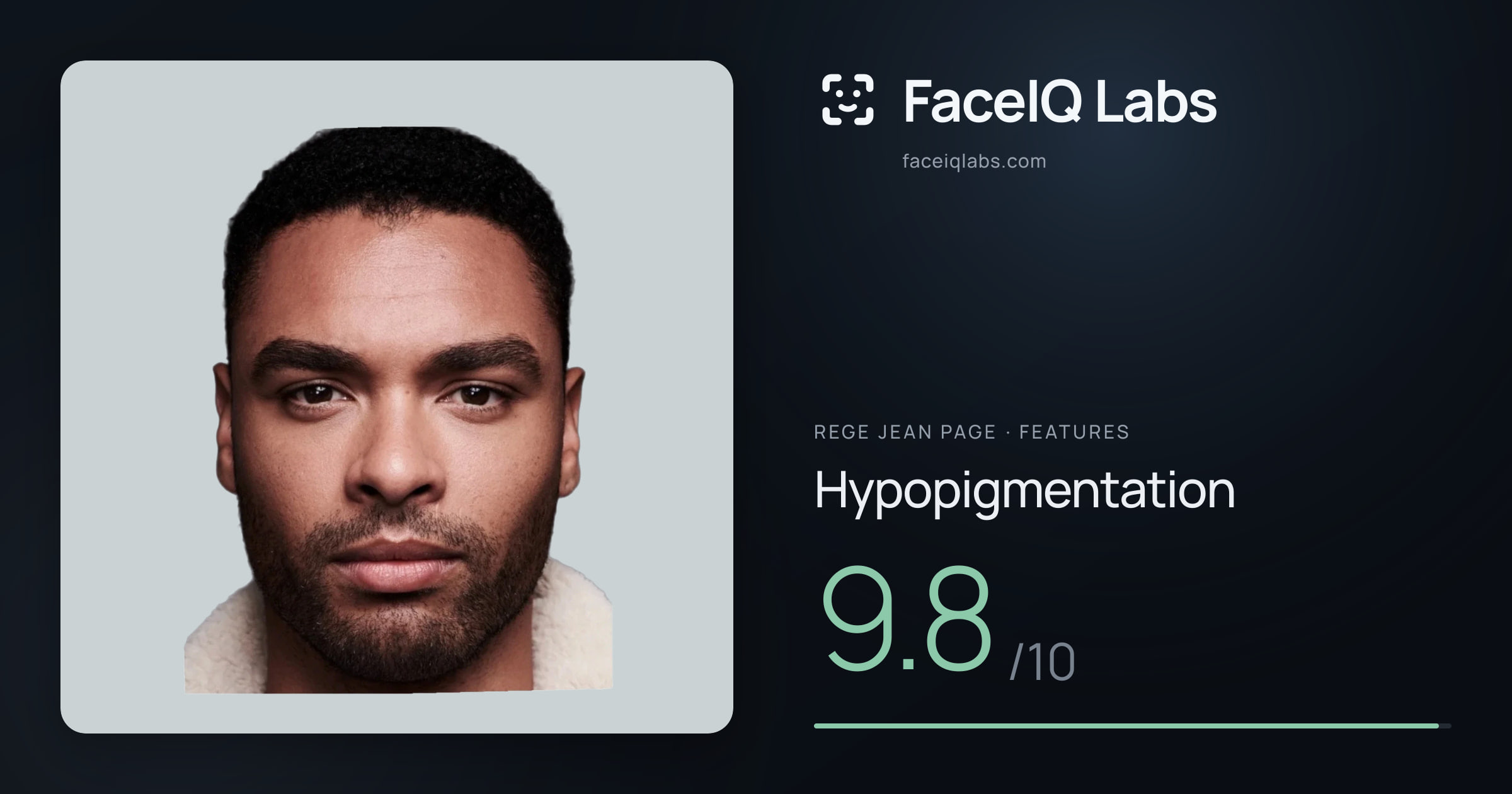 Rege Jean Page Hypopigmentation: 9.8/10, drawn on the photo