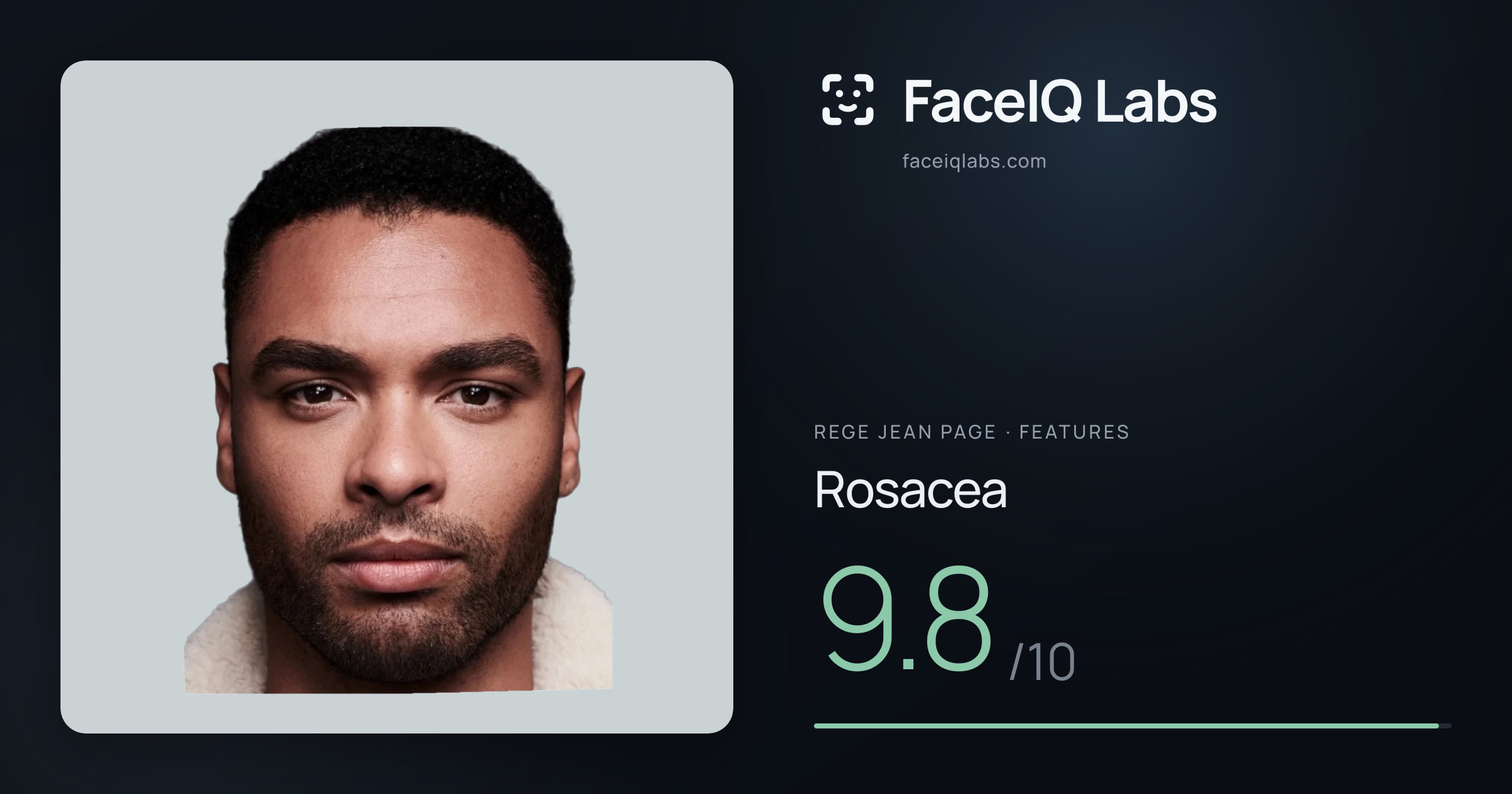 Rege Jean Page Rosacea: 9.8/10, drawn on the photo
