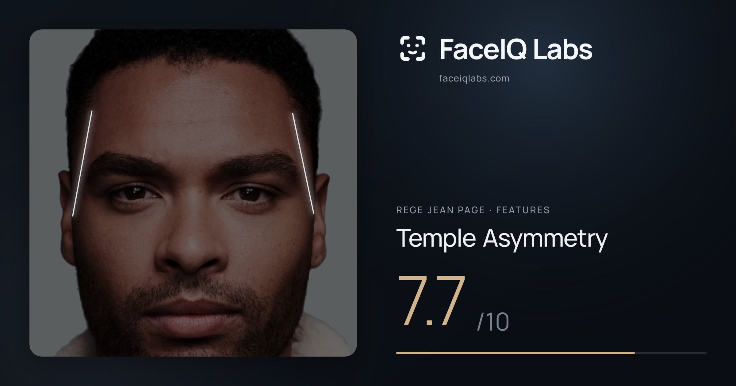 Rege Jean Page Temple Asymmetry: 7.7/10, drawn on the photo