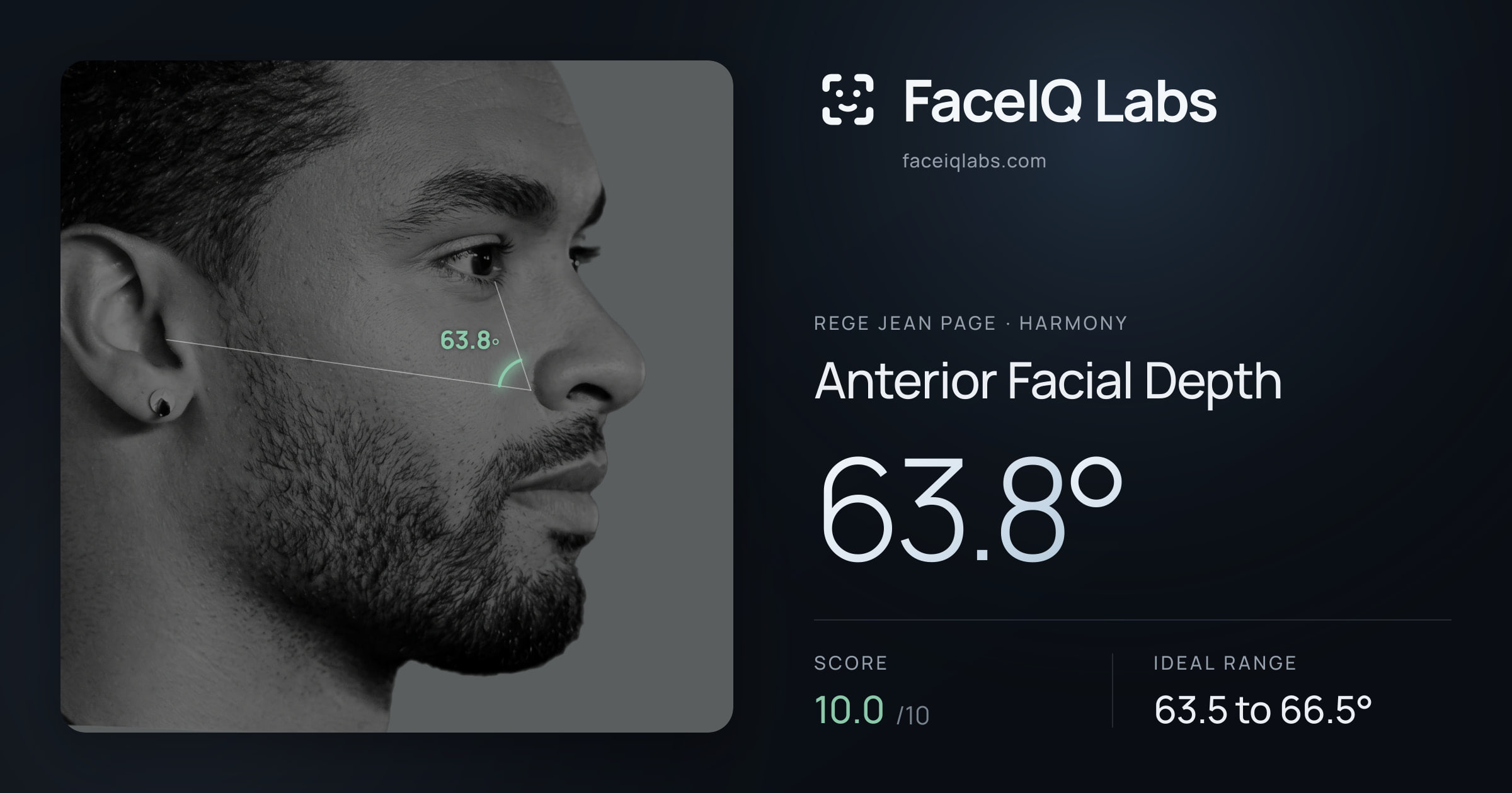 Rege Jean Page Anterior Facial Depth: 63.8°, drawn on the photo