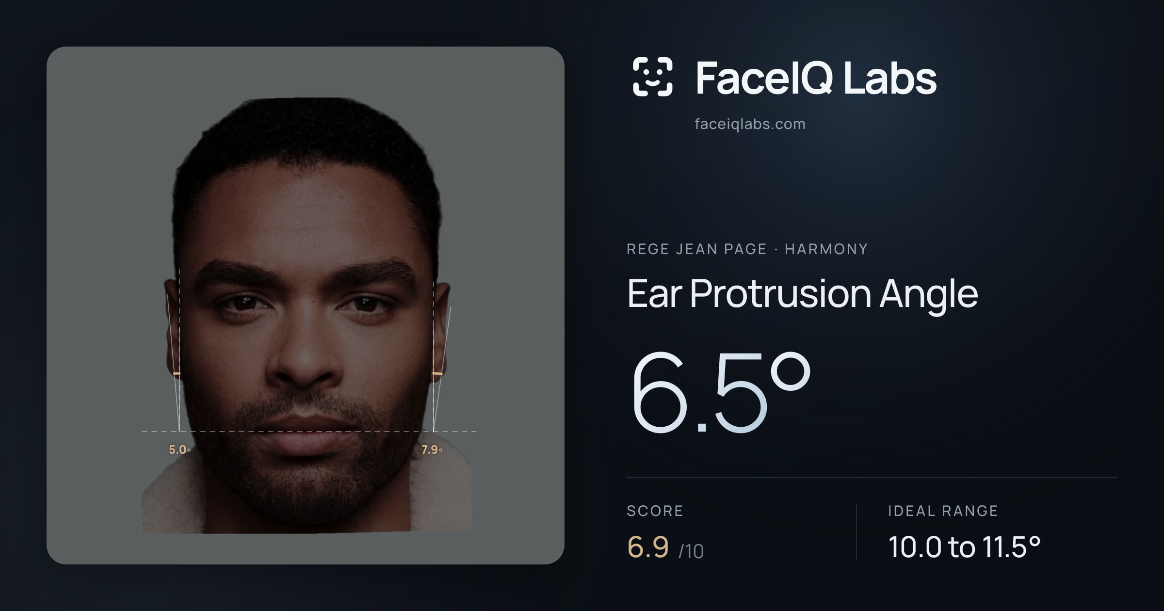 Rege Jean Page Ear Protrusion Angle: 6.5°, drawn on the photo