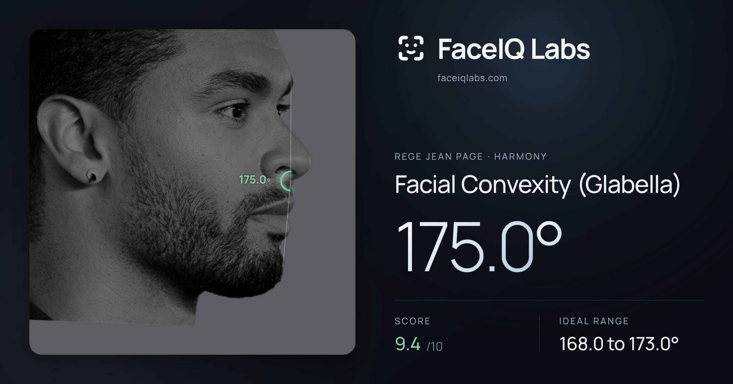 Rege Jean Page Facial Convexity (Glabella): 175.0°, drawn on the photo