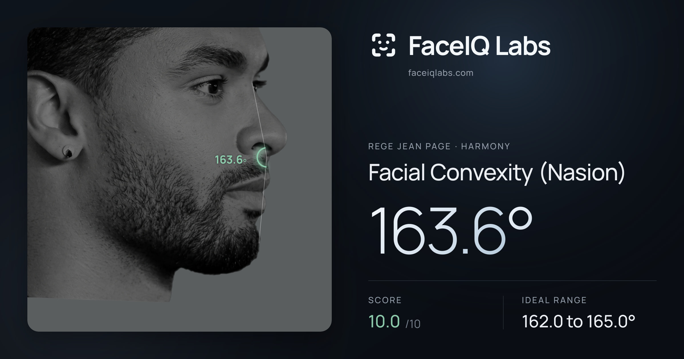Rege Jean Page Facial Convexity (Nasion): 163.6°, drawn on the photo
