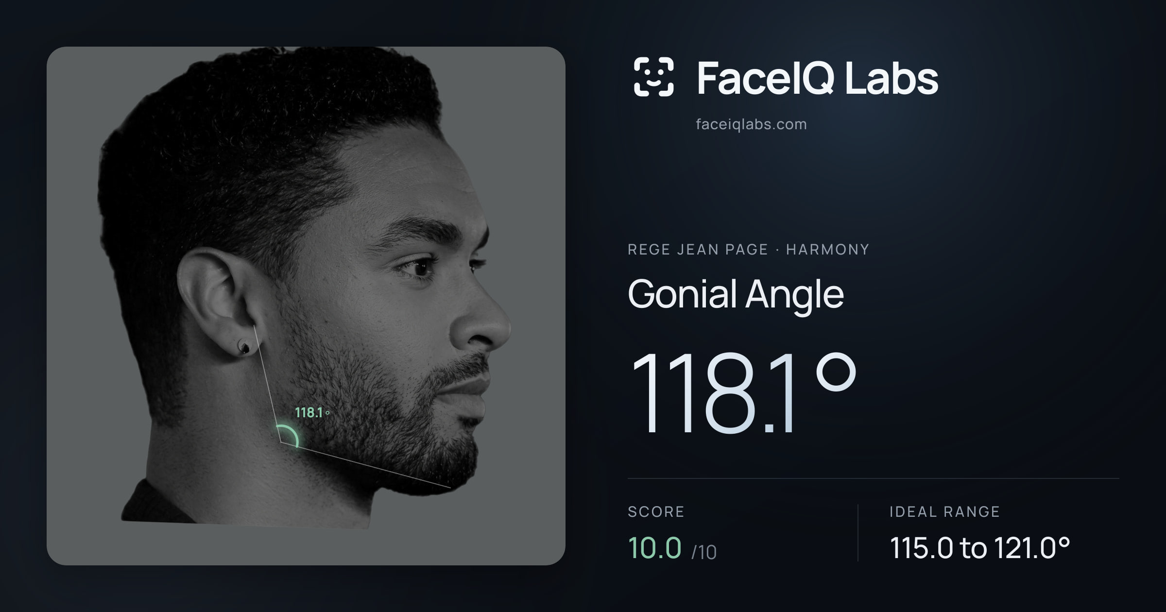 Rege Jean Page Gonial Angle: 118.1°, drawn on the photo