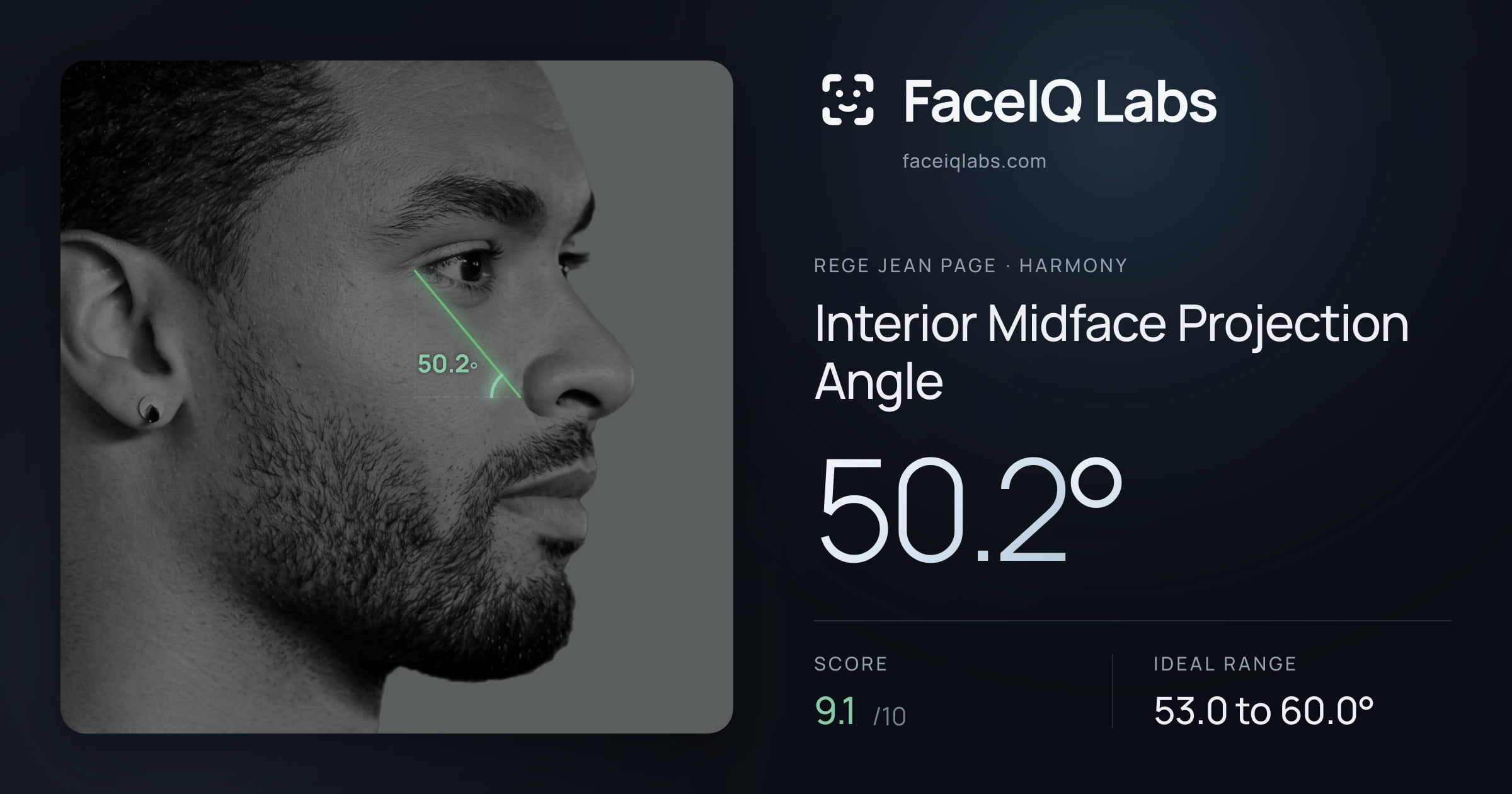 Rege Jean Page Interior Midface Projection Angle: 50.2°, drawn on the photo