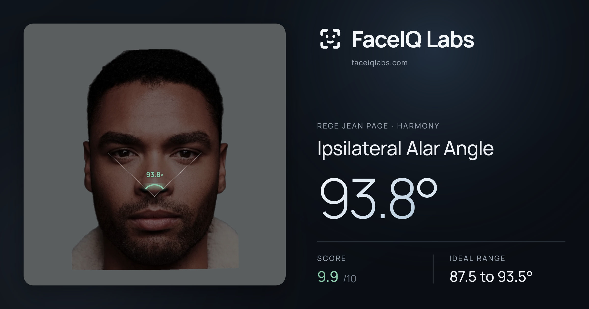 Rege Jean Page Ipsilateral Alar Angle: 93.8°, drawn on the photo