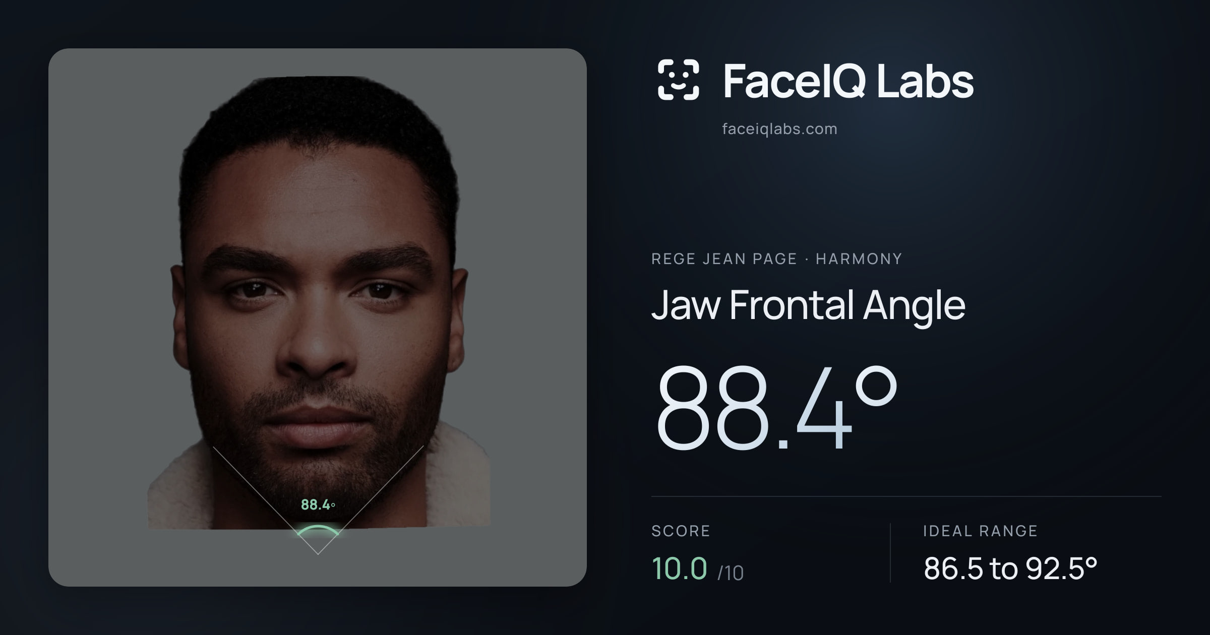 Rege Jean Page Jaw Frontal Angle: 88.4°, drawn on the photo