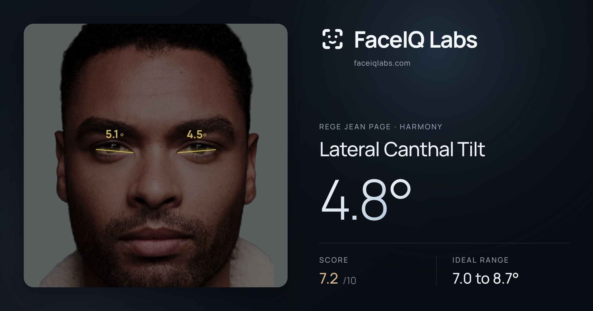 Rege Jean Page Lateral Canthal Tilt: 4.8°, drawn on the photo