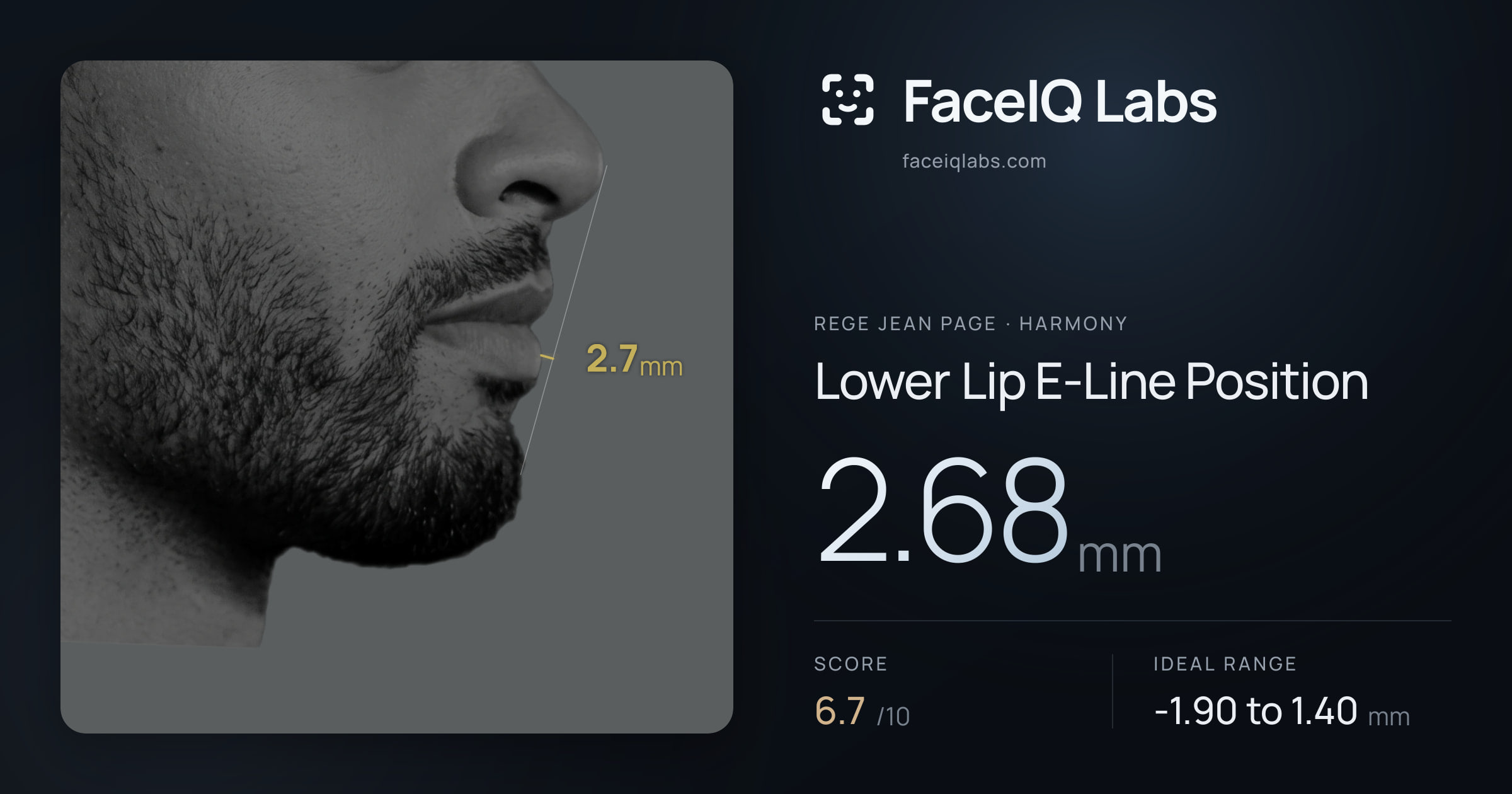 Rege Jean Page Lower Lip E-Line Position: 2.68mm, drawn on the photo
