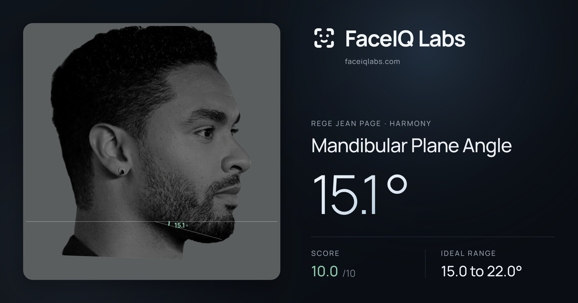 Rege Jean Page Mandibular Plane Angle: 15.1°, drawn on the photo
