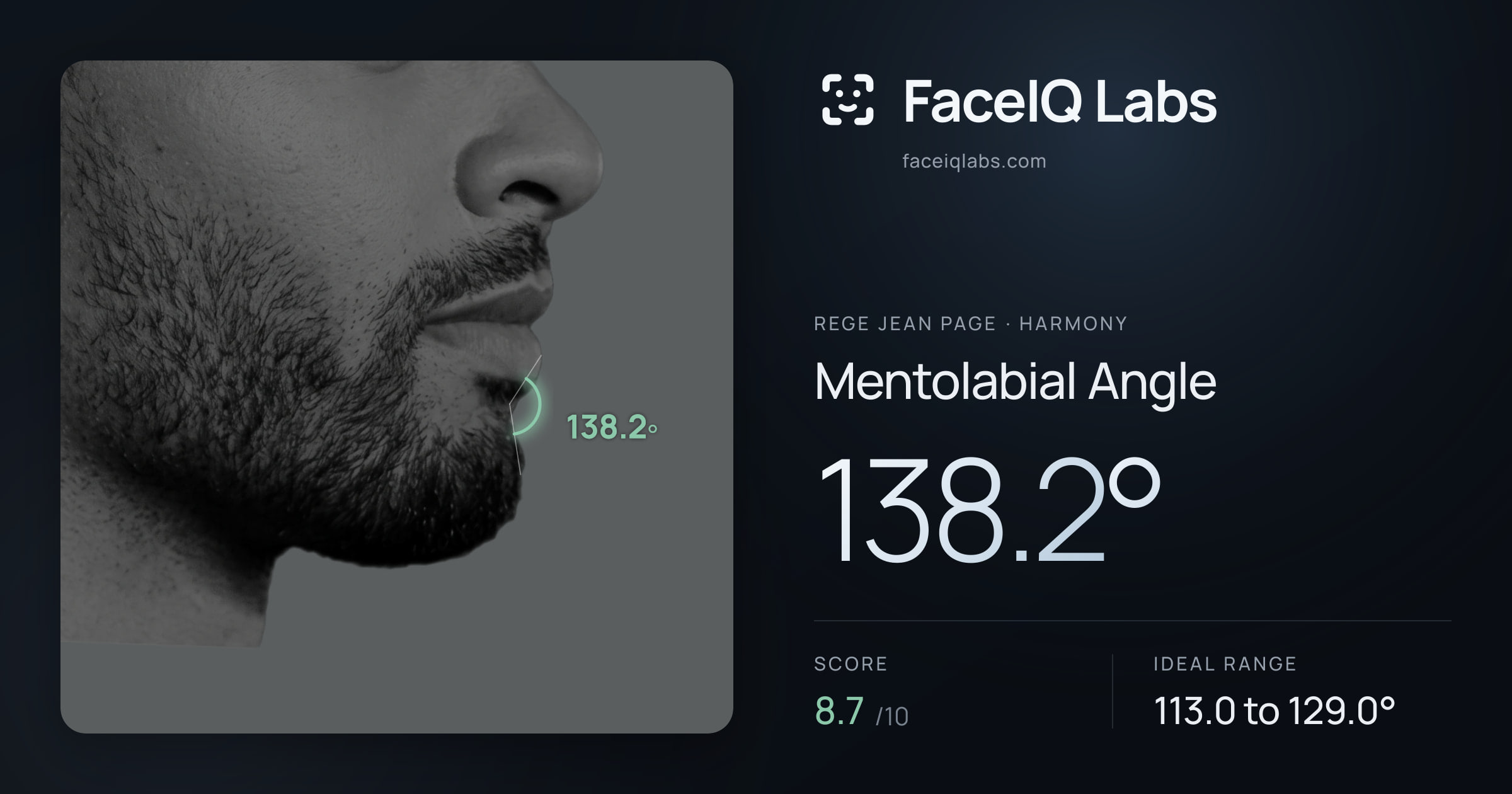 Rege Jean Page Mentolabial Angle: 138.2°, drawn on the photo