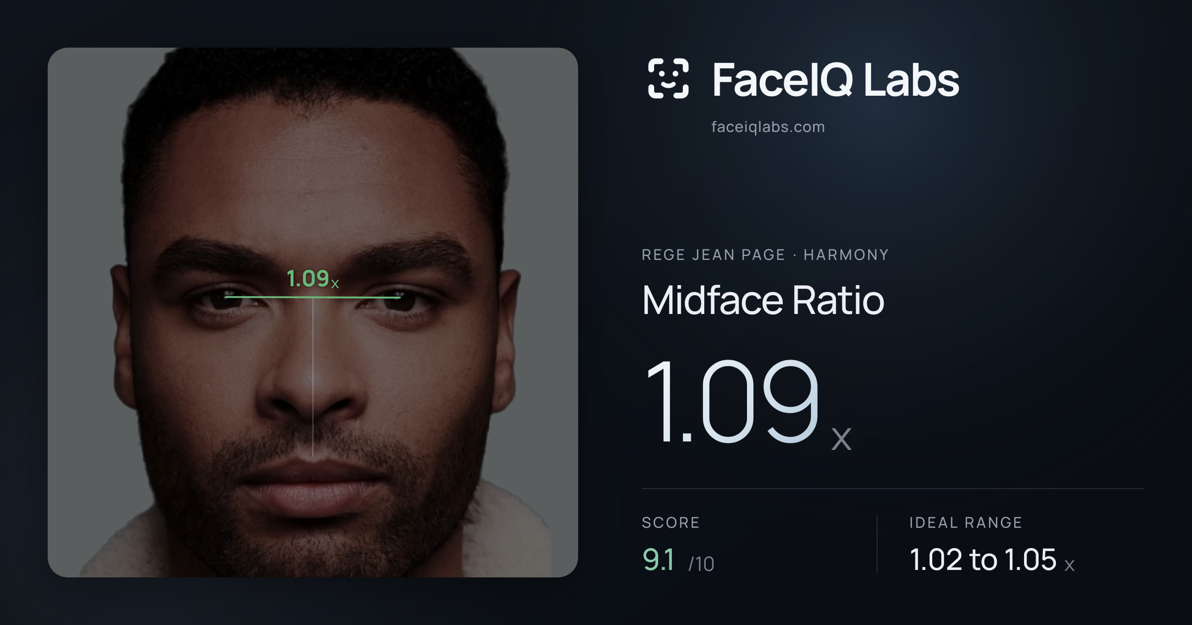 Rege Jean Page Midface Ratio: 1.09x, drawn on the photo