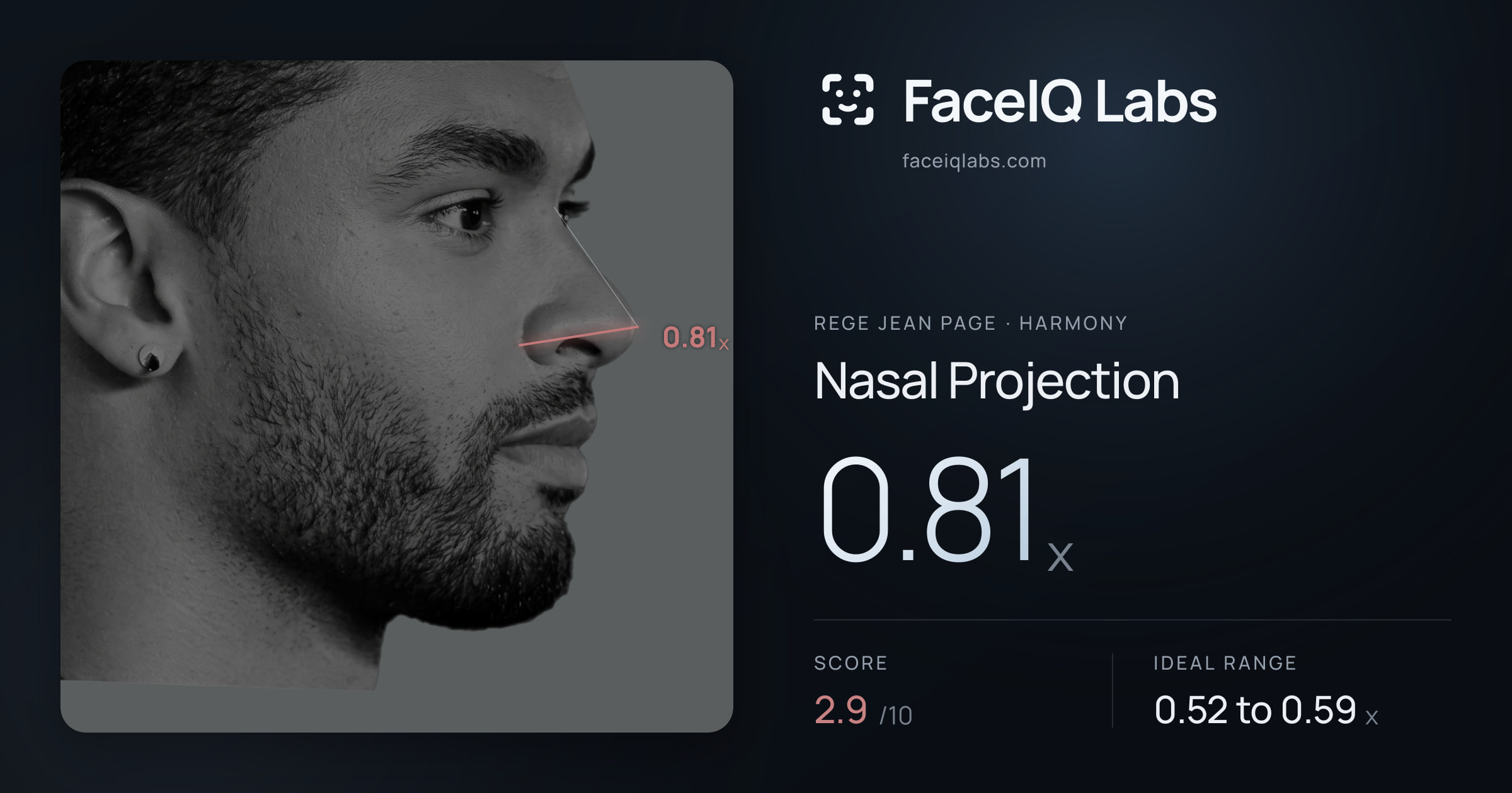 Rege Jean Page Nasal Projection: 0.81x, drawn on the photo