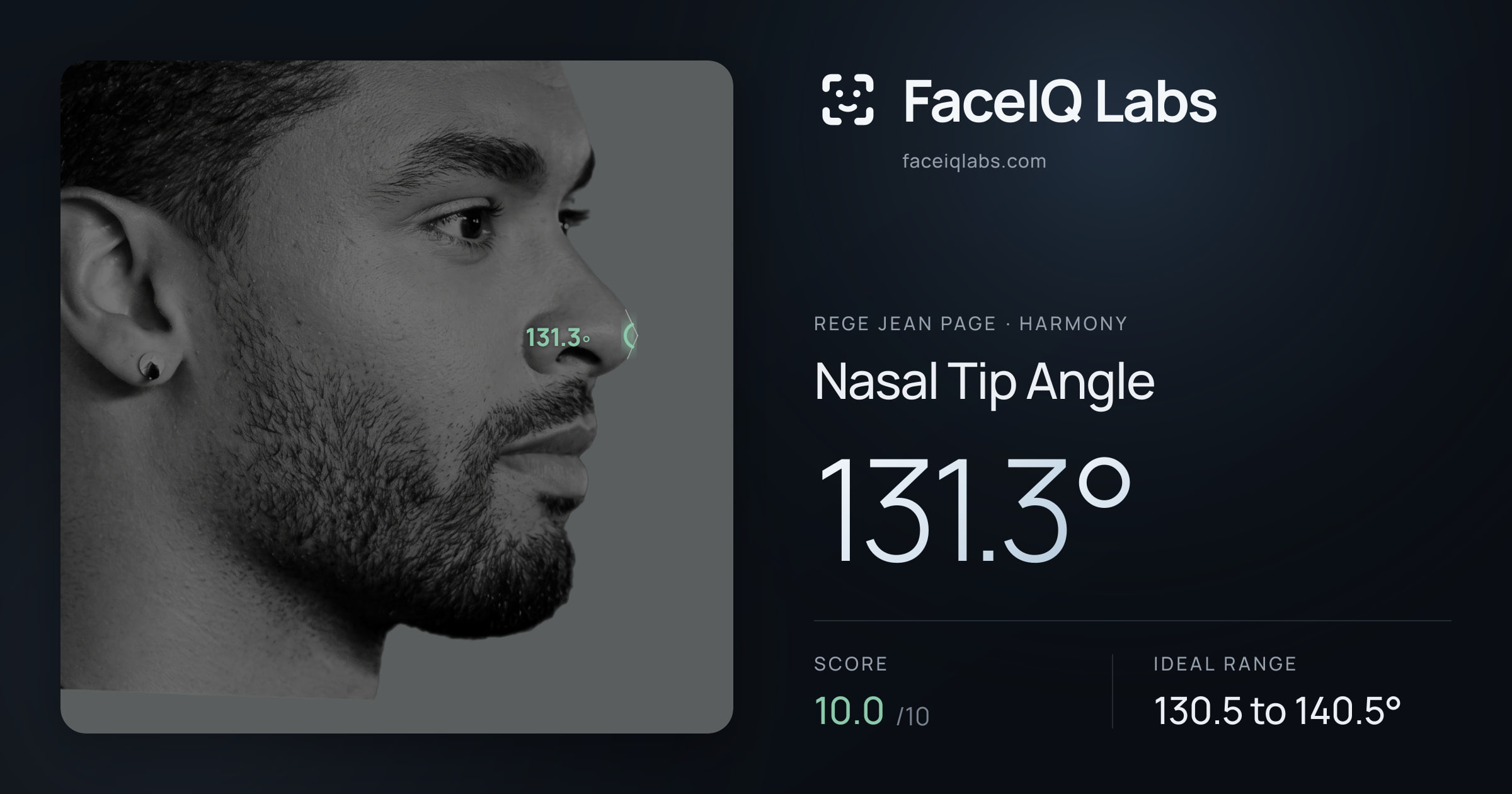 Rege Jean Page Nasal Tip Angle: 131.3°, drawn on the photo