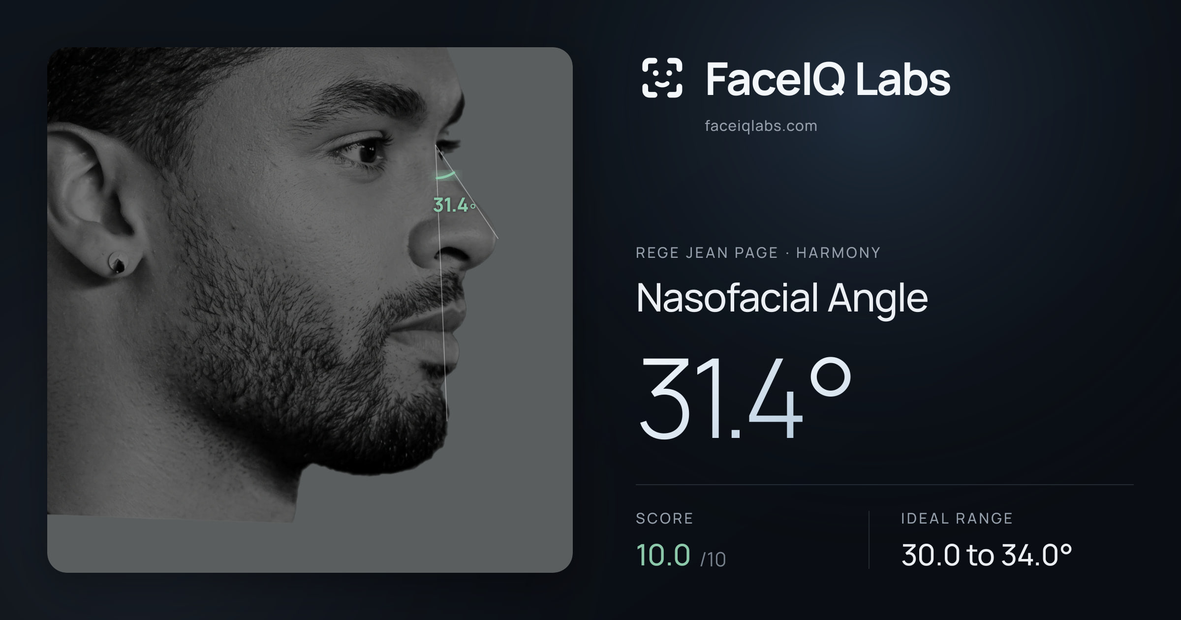 Rege Jean Page Nasofacial Angle: 31.4°, drawn on the photo