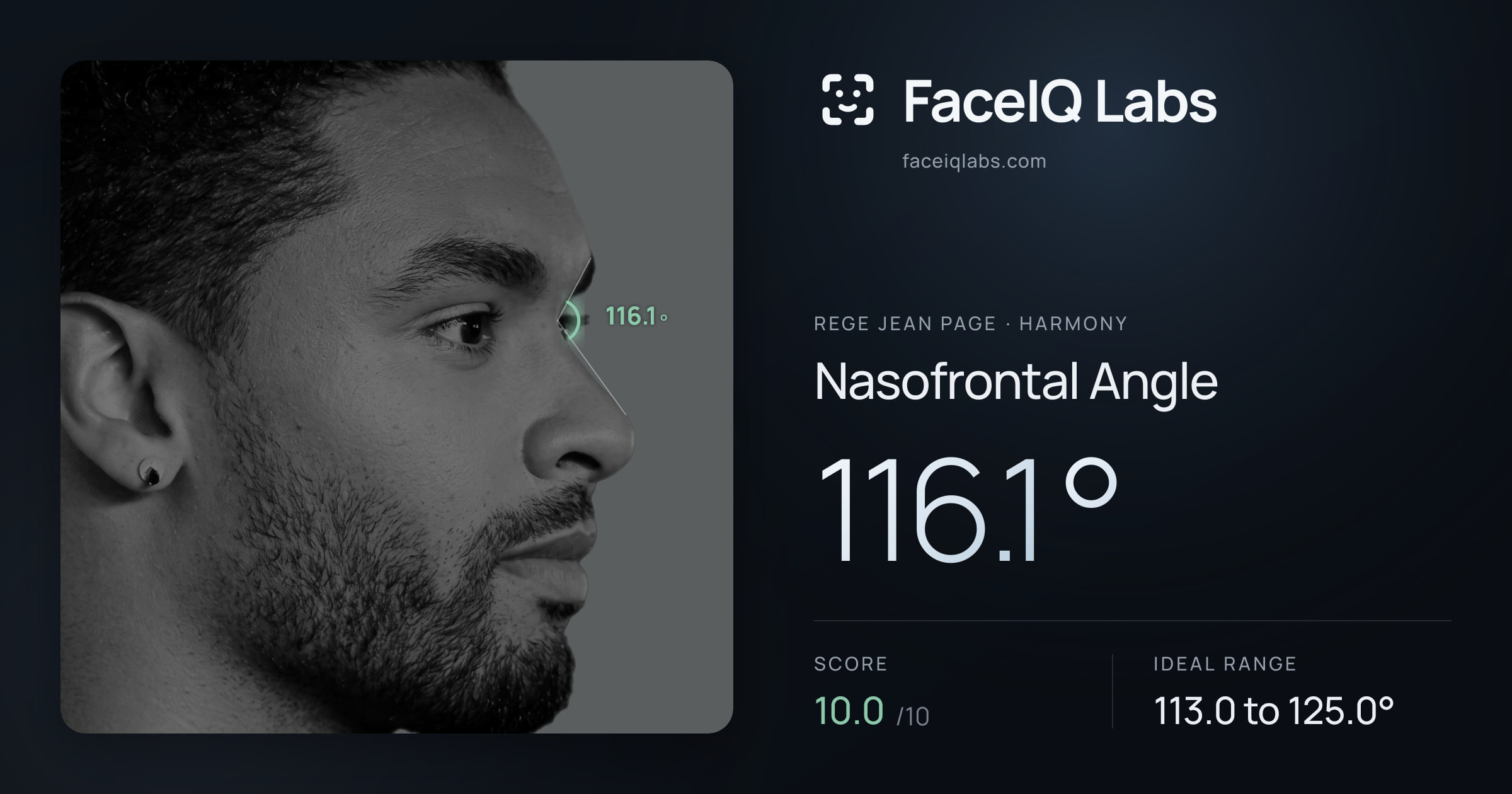 Rege Jean Page Nasofrontal Angle: 116.1°, drawn on the photo
