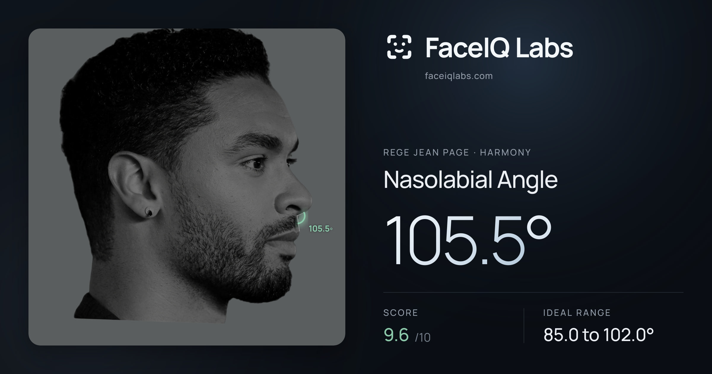 Rege Jean Page Nasolabial Angle: 105.5°, drawn on the photo