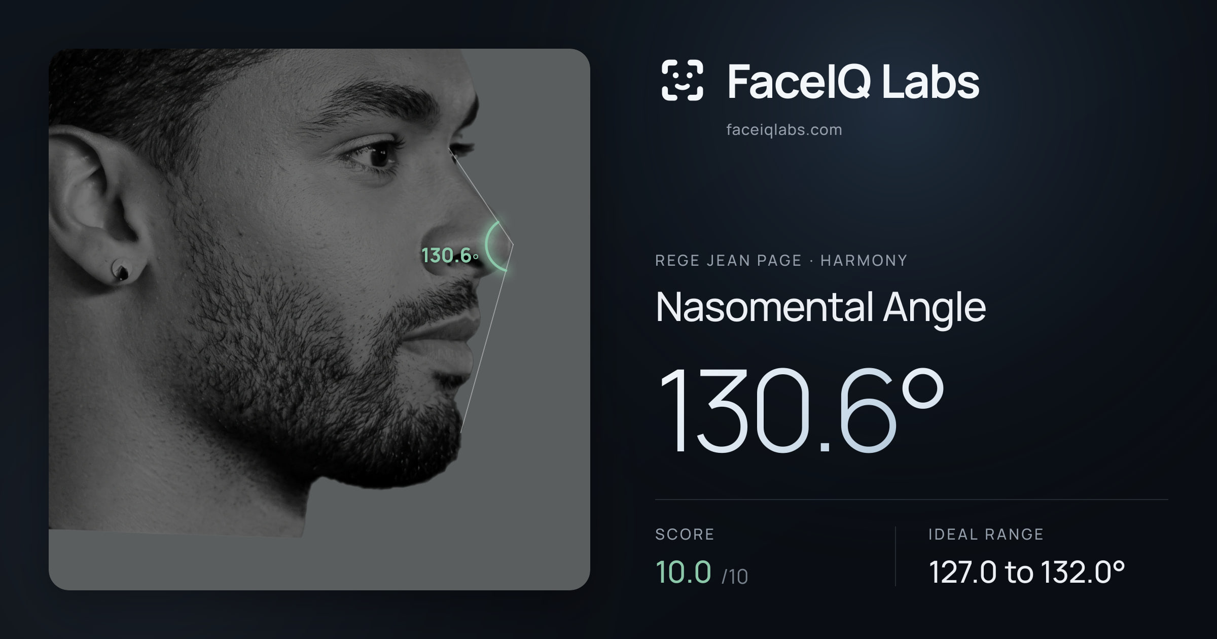 Rege Jean Page Nasomental Angle: 130.6°, drawn on the photo