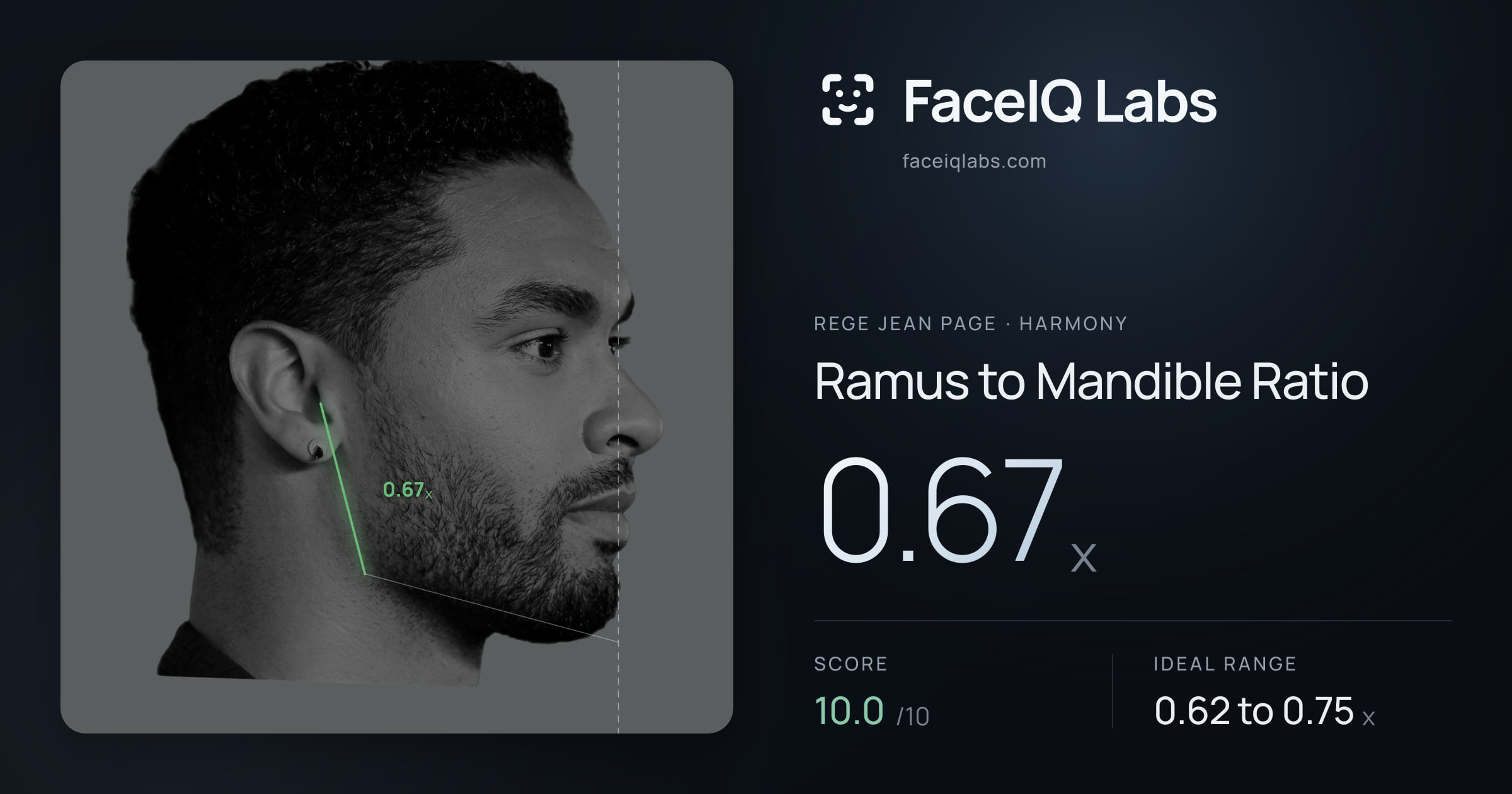 Rege Jean Page Ramus to Mandible Ratio: 0.67x, drawn on the photo