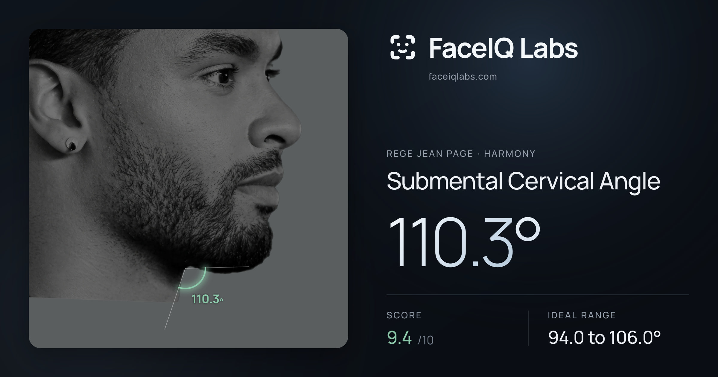 Rege Jean Page Submental Cervical Angle: 110.3°, drawn on the photo