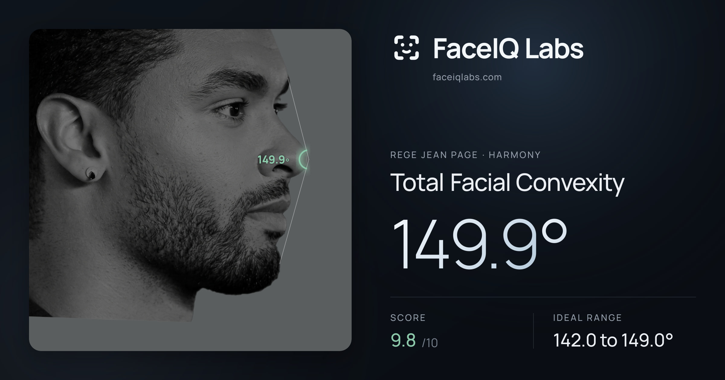 Rege Jean Page Total Facial Convexity: 149.9°, drawn on the photo