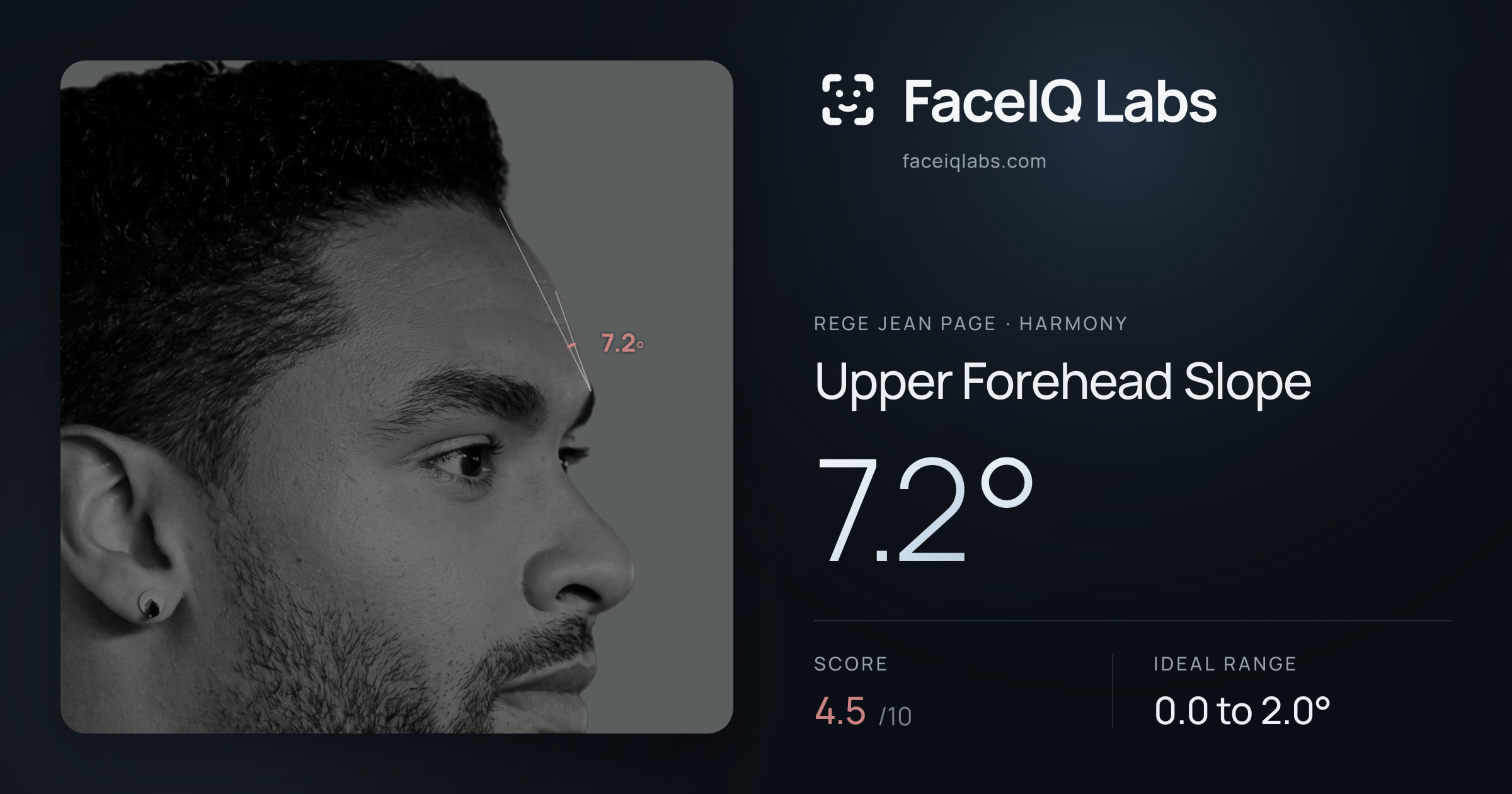Rege Jean Page Upper Forehead Slope: 7.2°, drawn on the photo