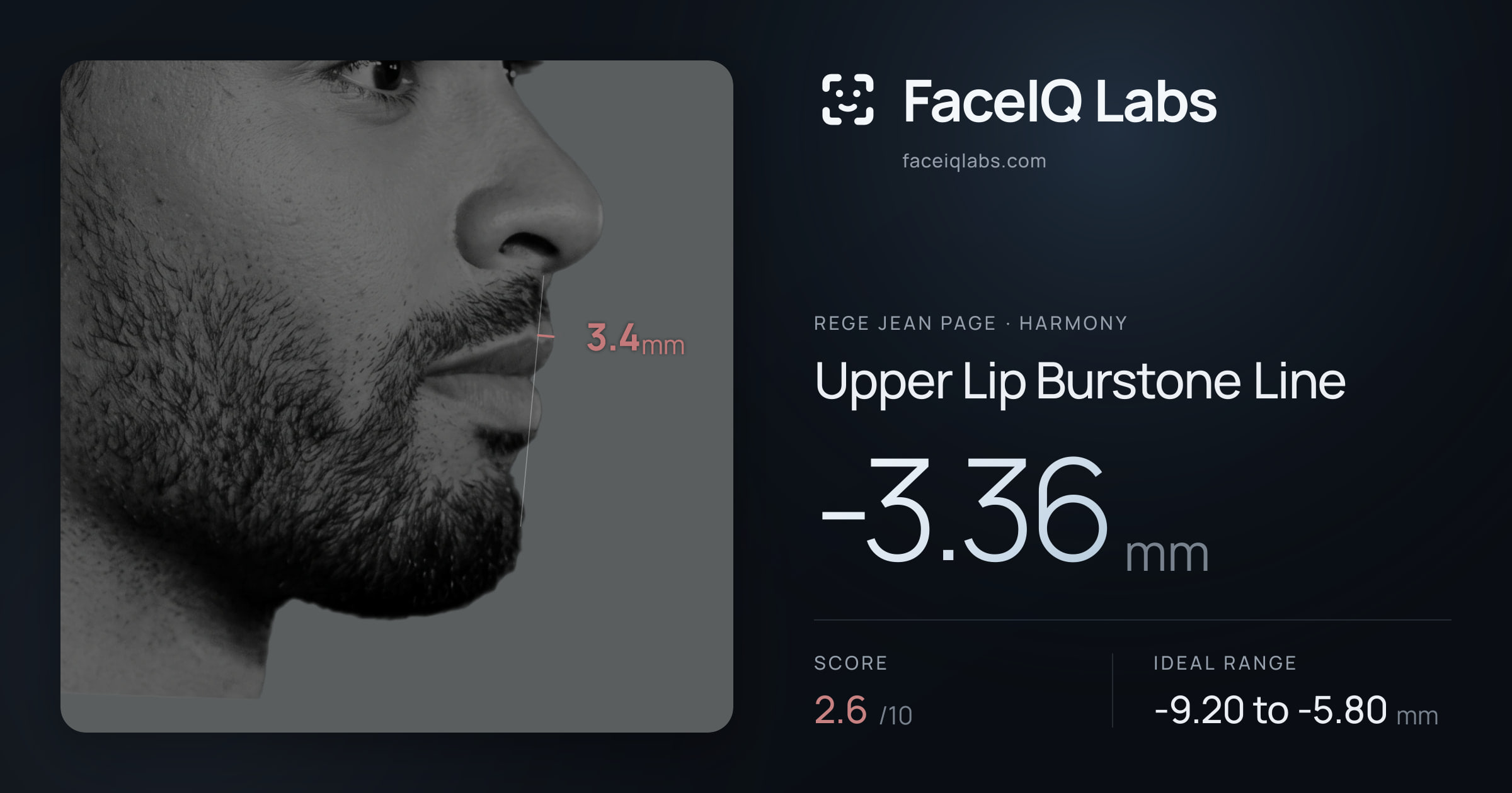 Rege Jean Page Upper Lip Burstone Line: -3.36mm, drawn on the photo