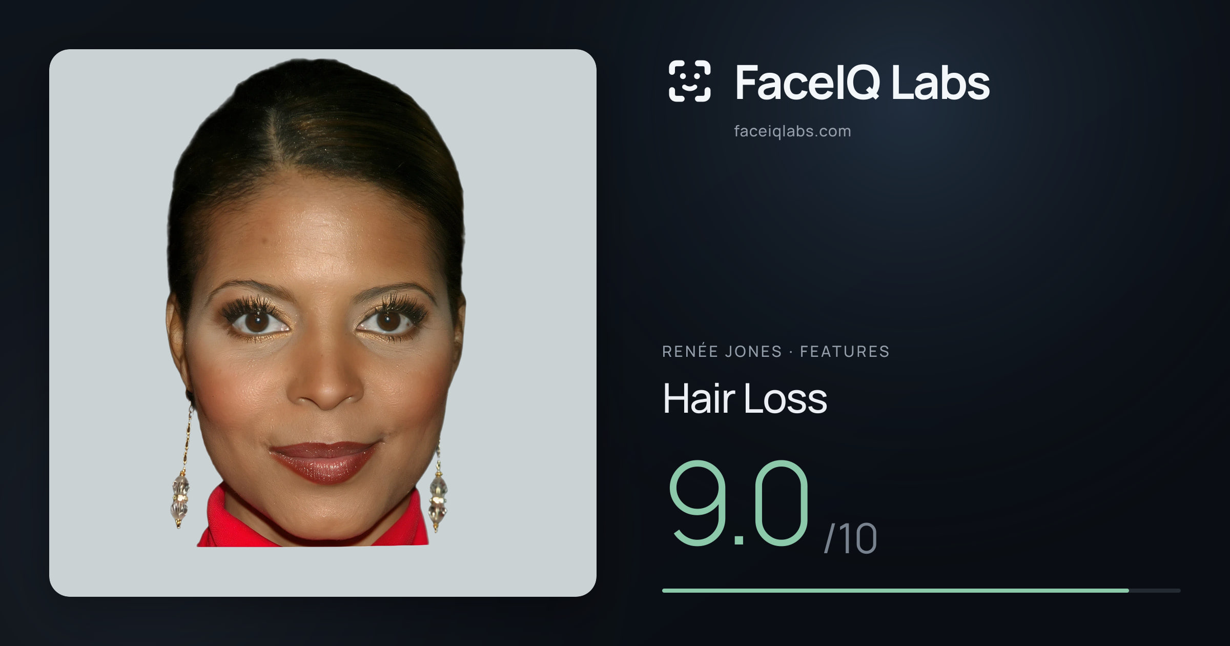 Renée Jones Hair Loss: 9.0/10, drawn on the photo