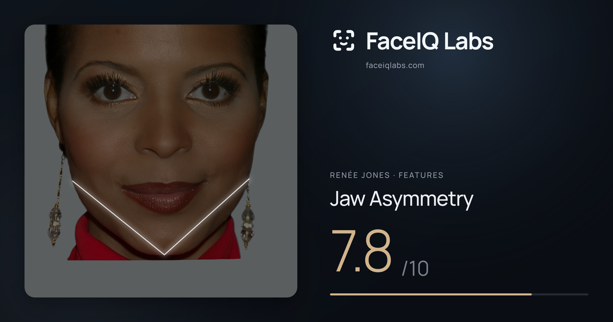 Renée Jones Jaw Asymmetry: 7.8/10, drawn on the photo
