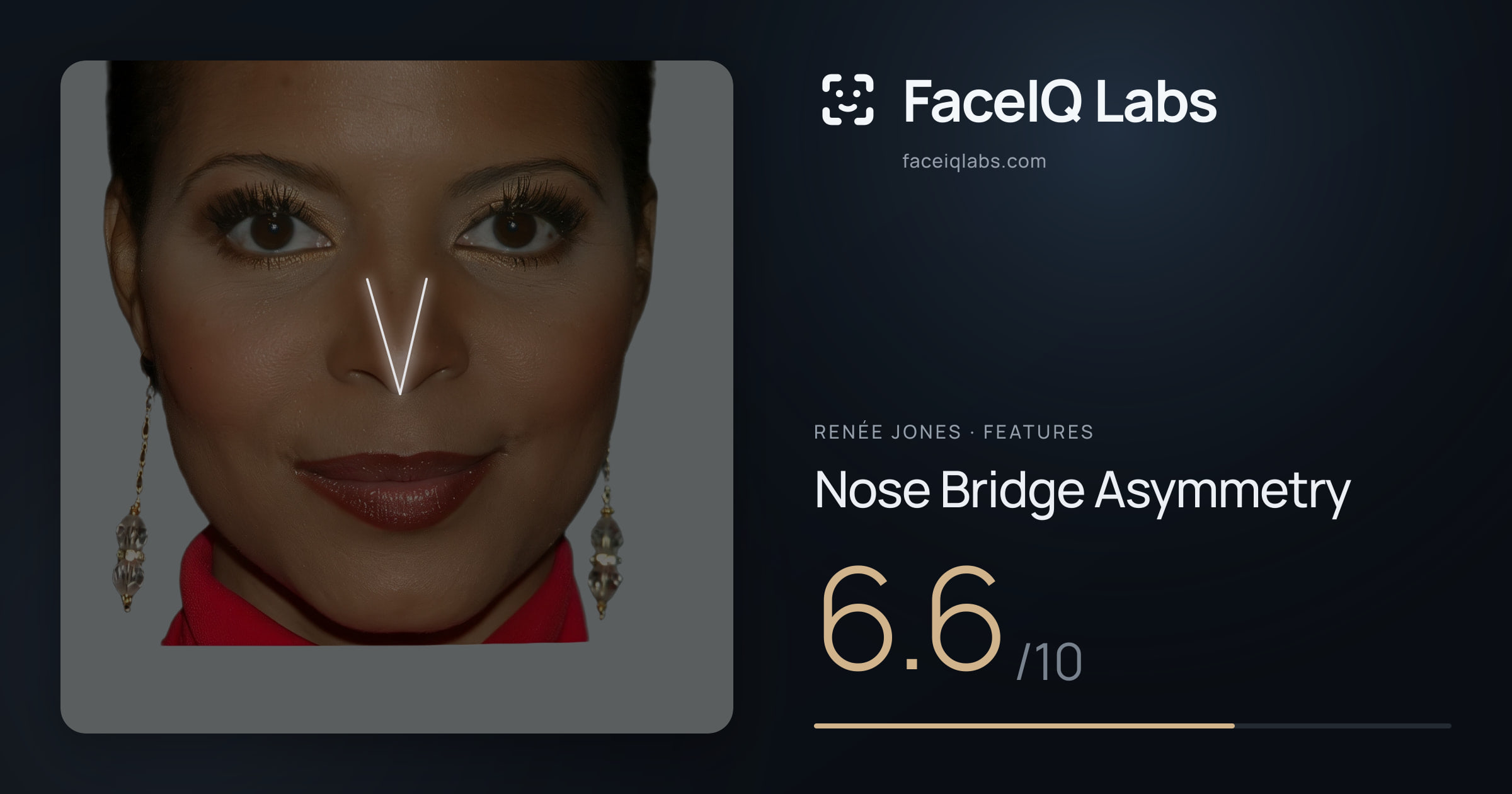 Renée Jones Nose Bridge Asymmetry: 6.6/10, drawn on the photo