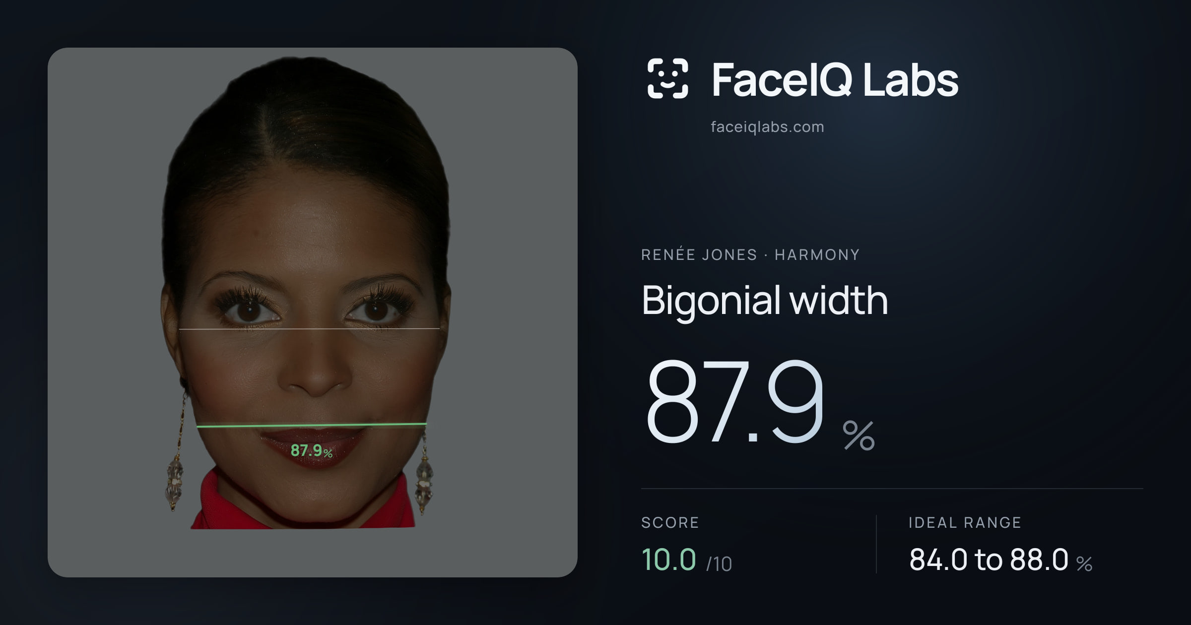 Renée Jones Bigonial width: 87.9%, drawn on the photo