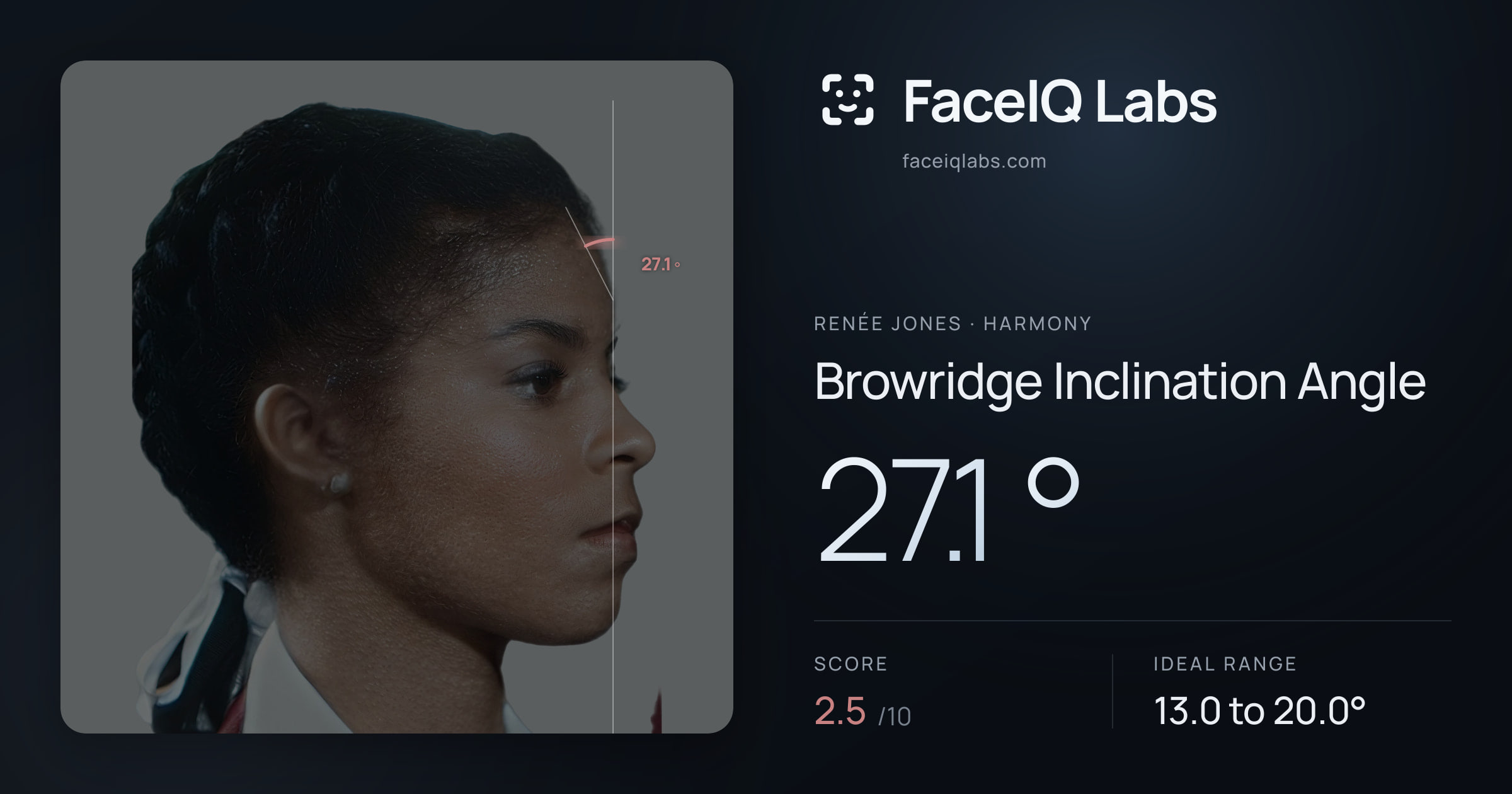 Renée Jones Browridge Inclination Angle: 27.1°, drawn on the photo