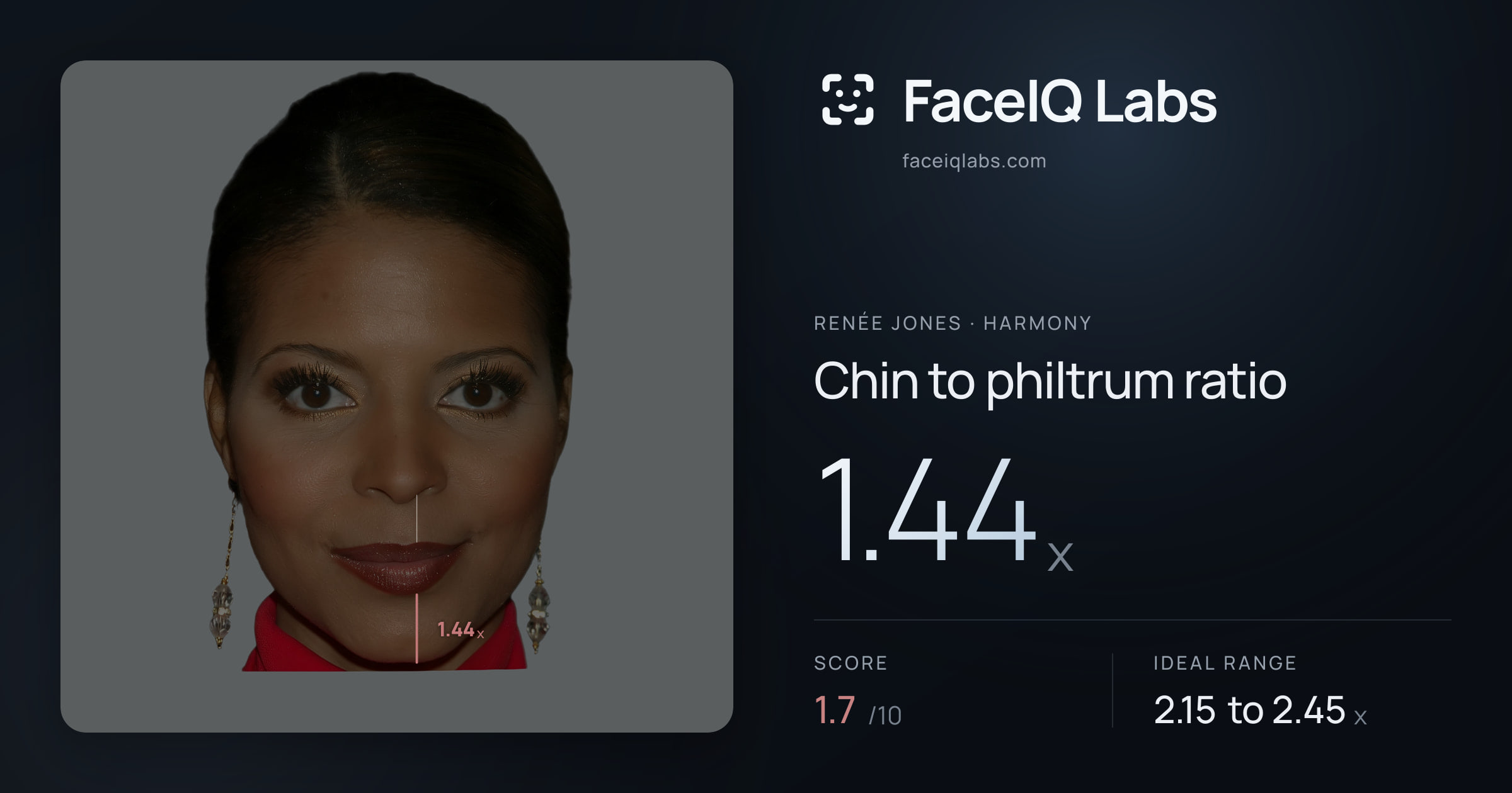 Renée Jones Chin to philtrum ratio: 1.44x, drawn on the photo