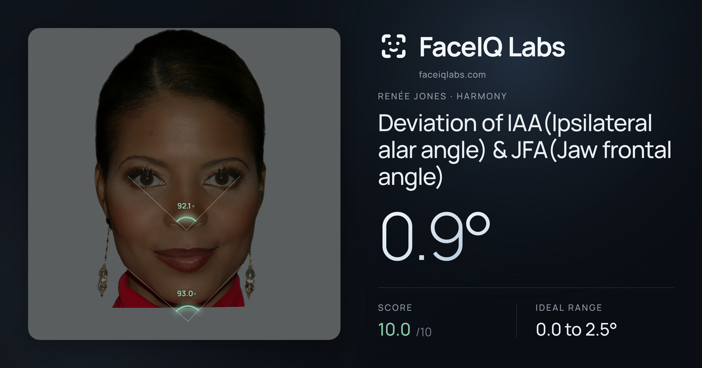 Renée Jones Deviation of IAA(Ipsilateral alar angle) & JFA(Jaw frontal angle): 0.9°, drawn on the photo
