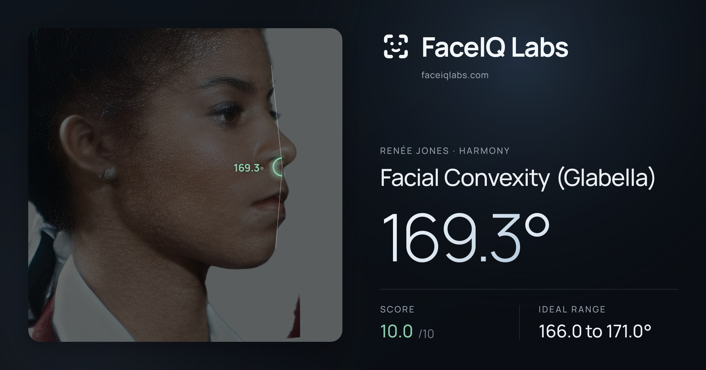 Renée Jones Facial Convexity (Glabella): 169.3°, drawn on the photo