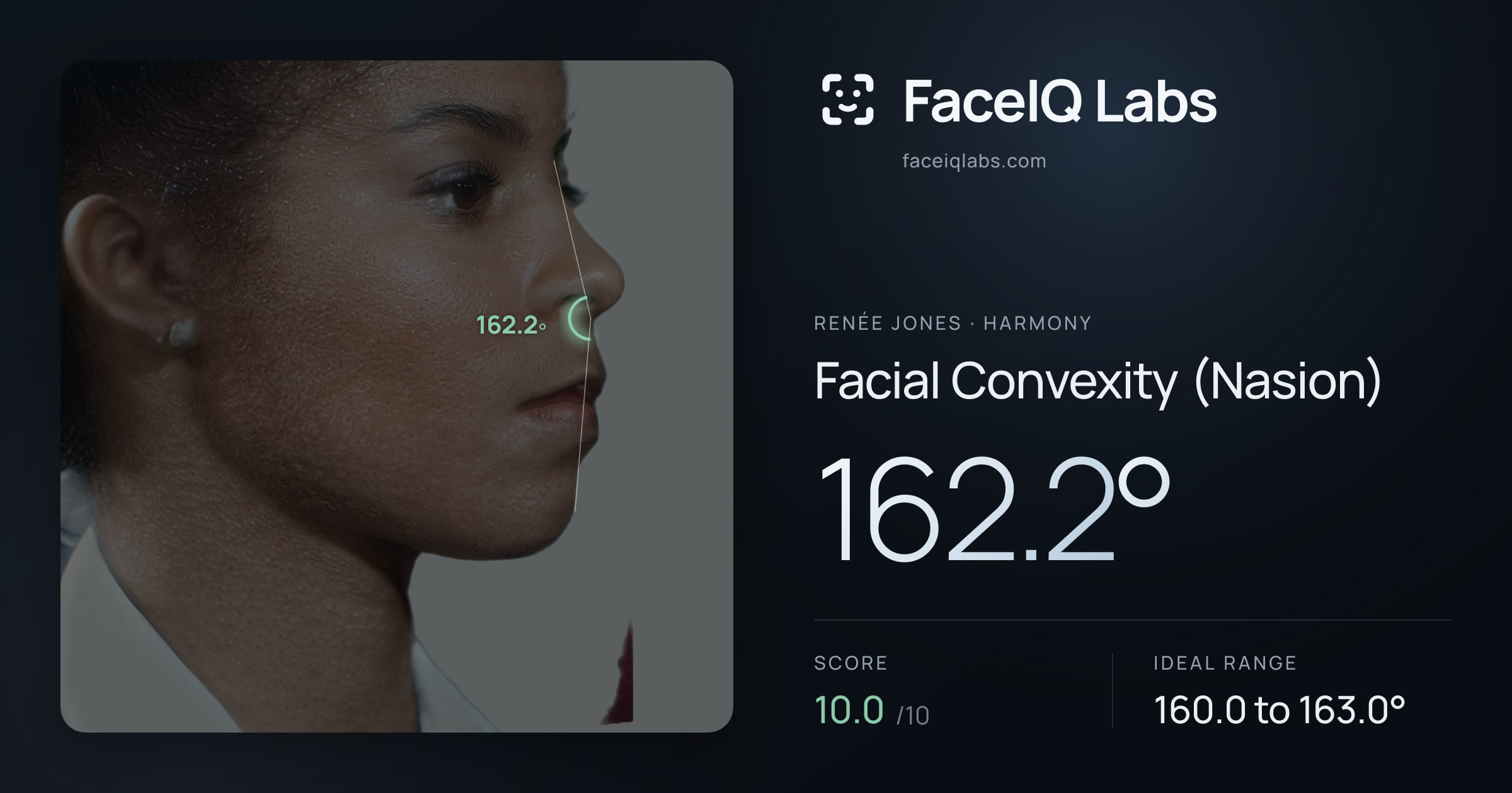Renée Jones Facial Convexity (Nasion): 162.2°, drawn on the photo