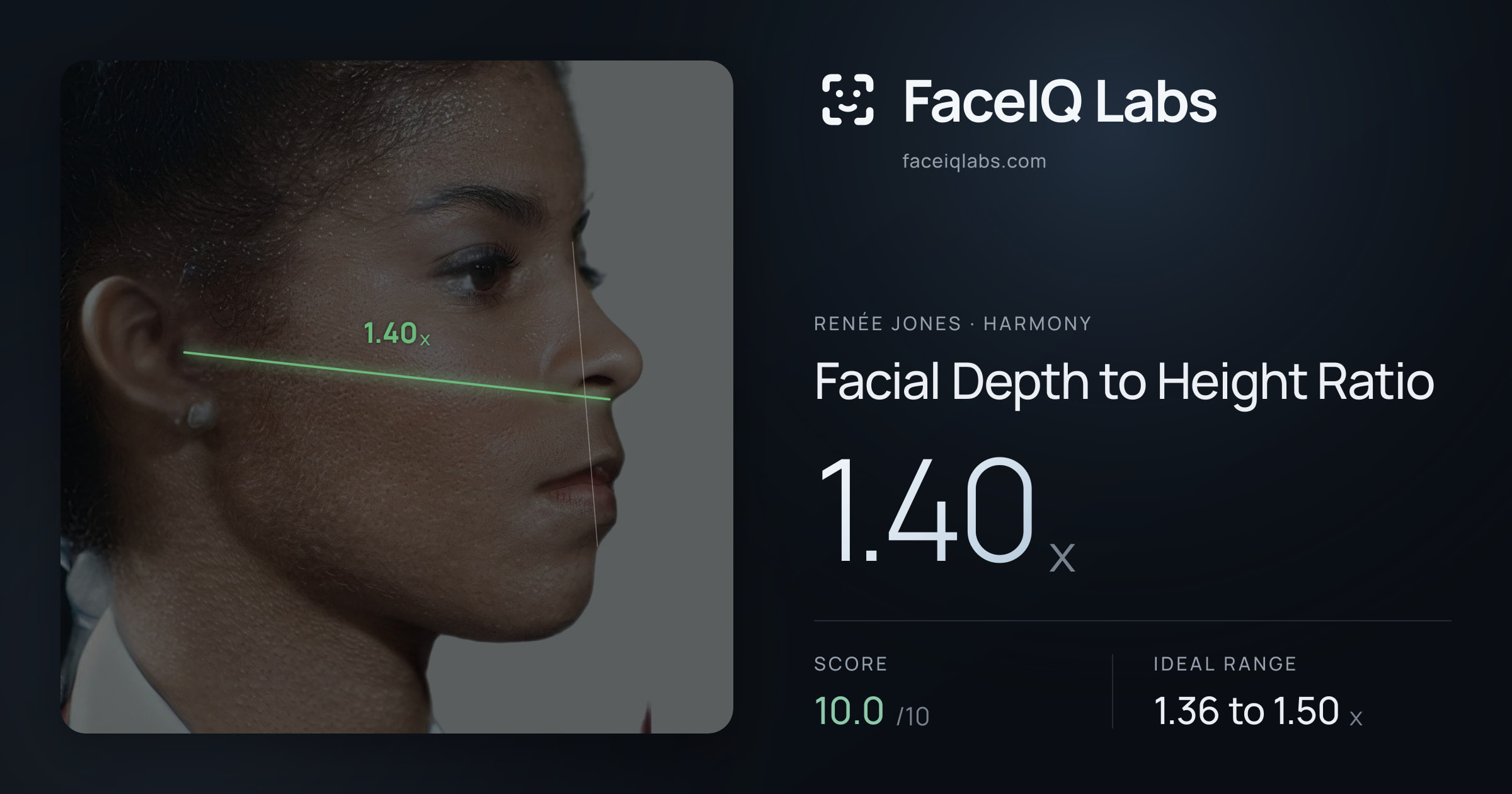 Renée Jones Facial Depth to Height Ratio: 1.40x, drawn on the photo