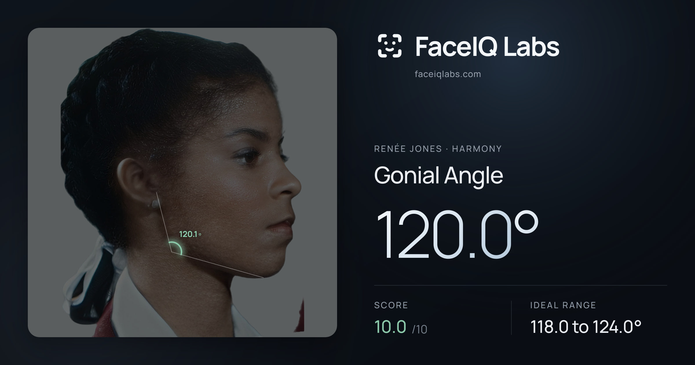 Renée Jones Gonial Angle: 120.0°, drawn on the photo