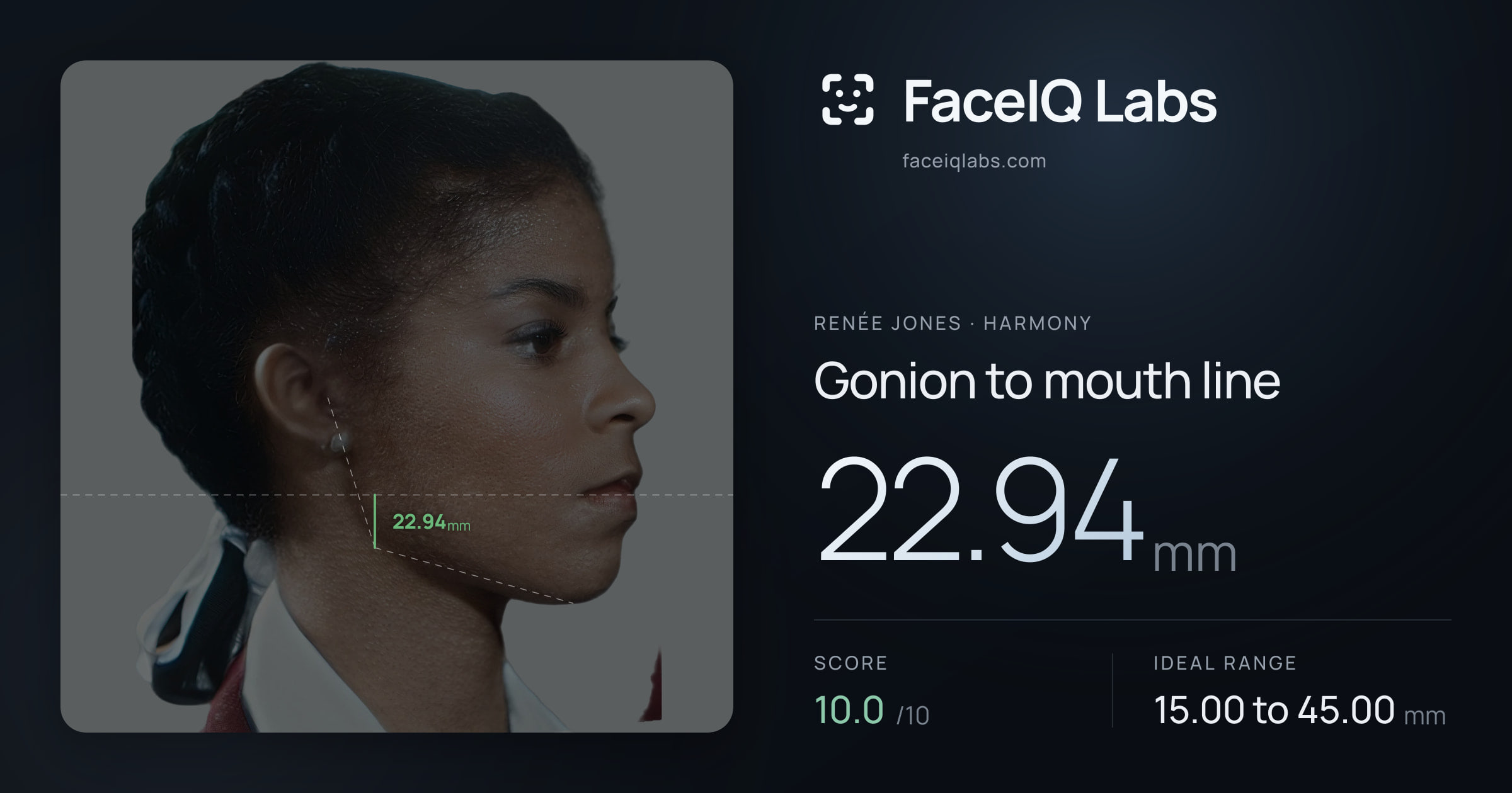 Renée Jones Gonion to mouth line: 22.94mm, drawn on the photo