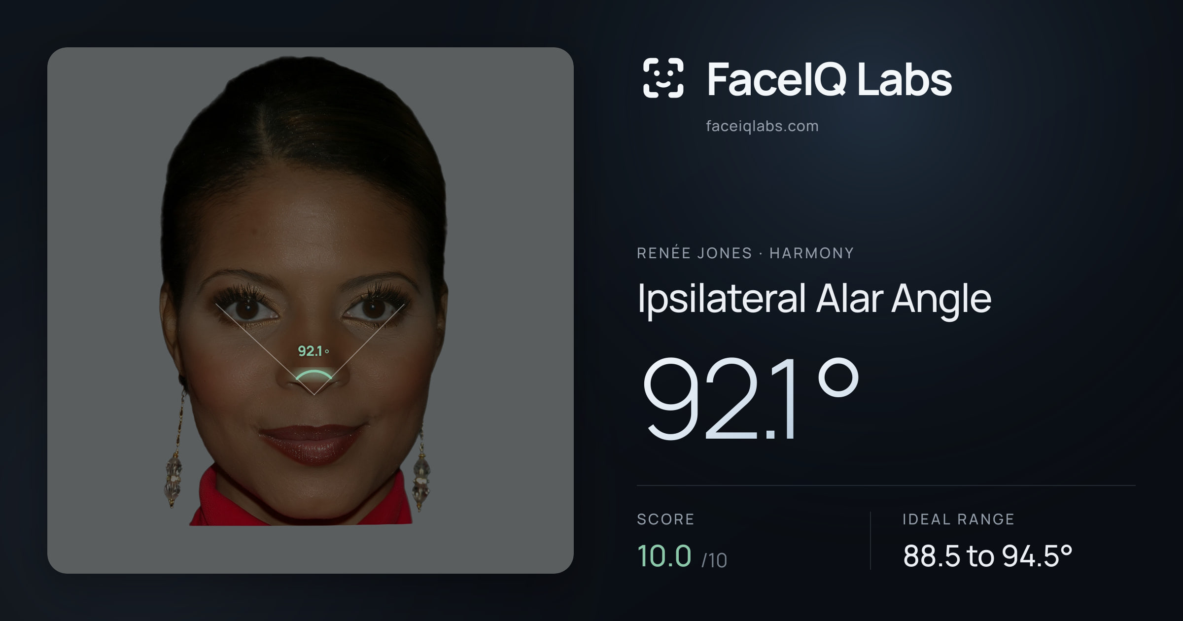 Renée Jones Ipsilateral Alar Angle: 92.1°, drawn on the photo