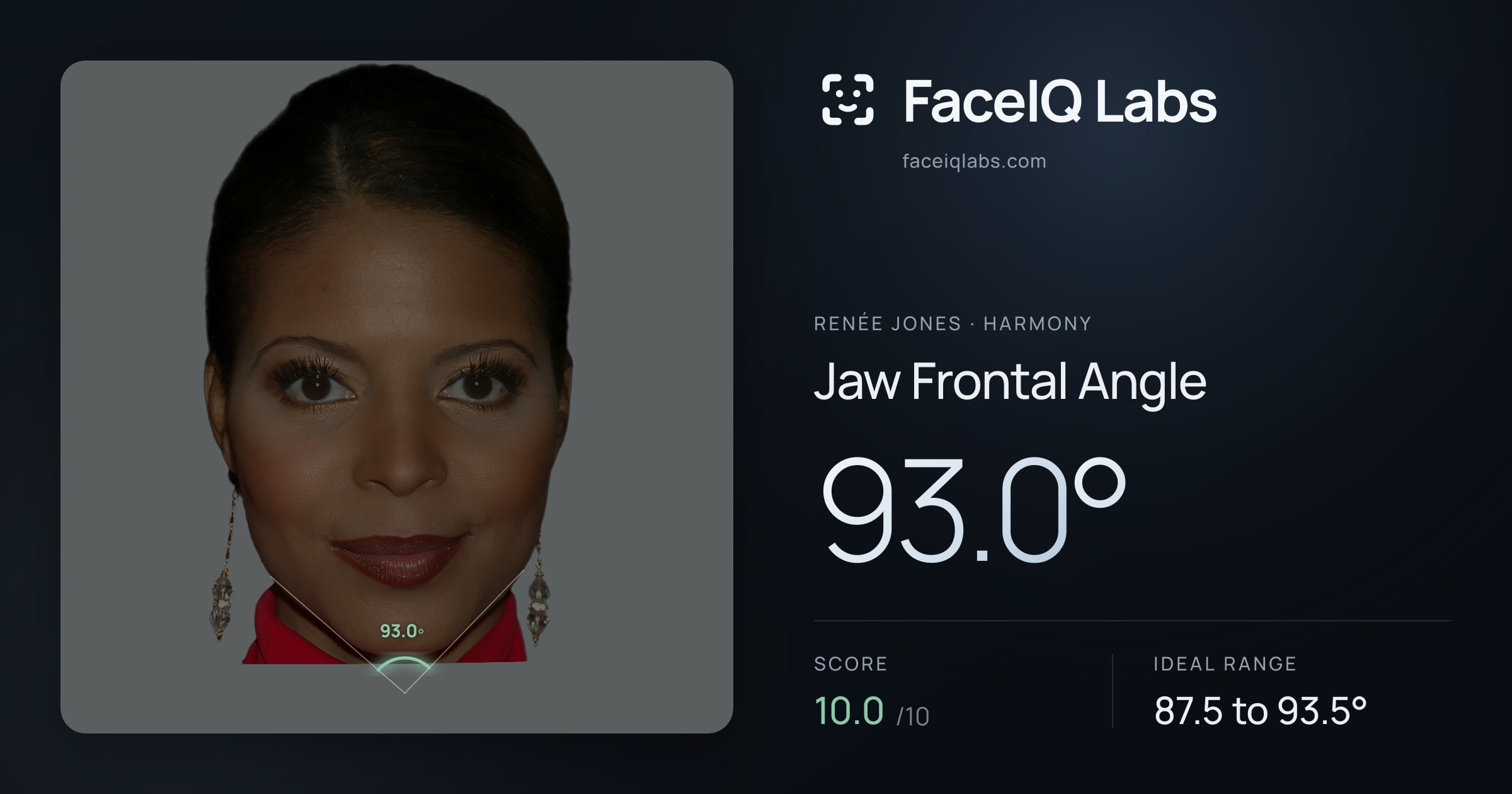 Renée Jones Jaw Frontal Angle: 93.0°, drawn on the photo