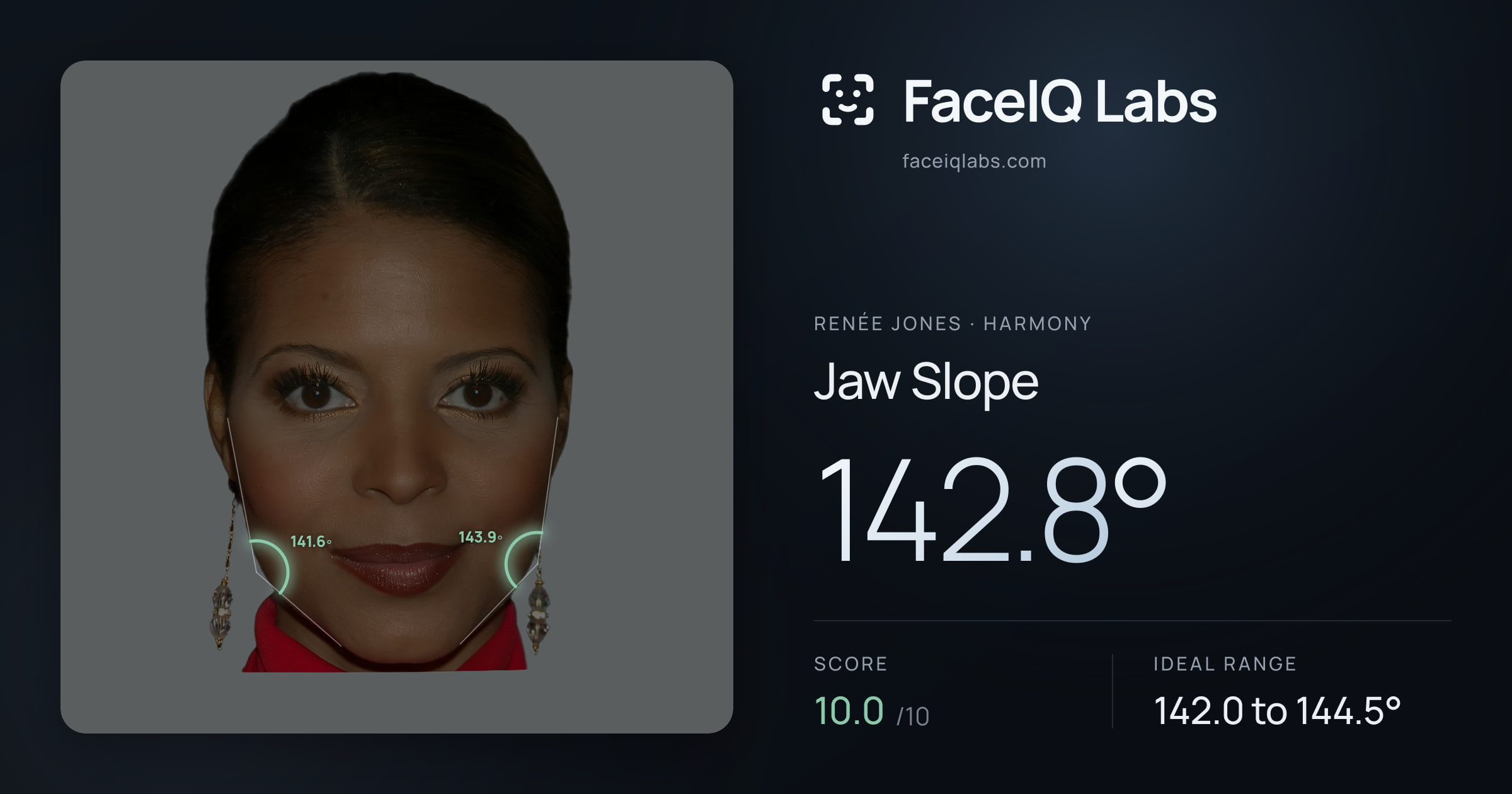 Renée Jones Jaw Slope: 142.8°, drawn on the photo