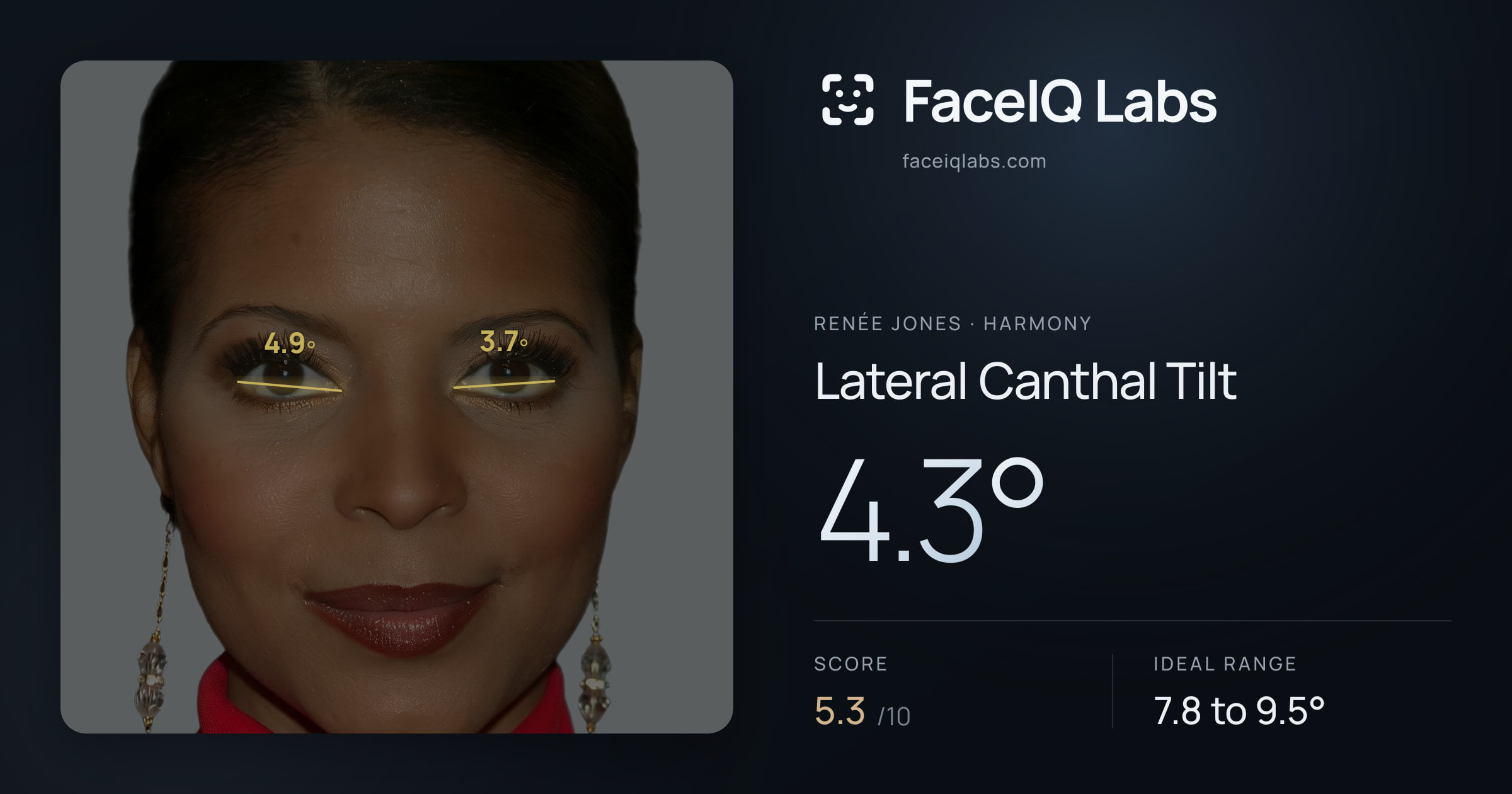 Renée Jones Lateral Canthal Tilt: 4.3°, drawn on the photo