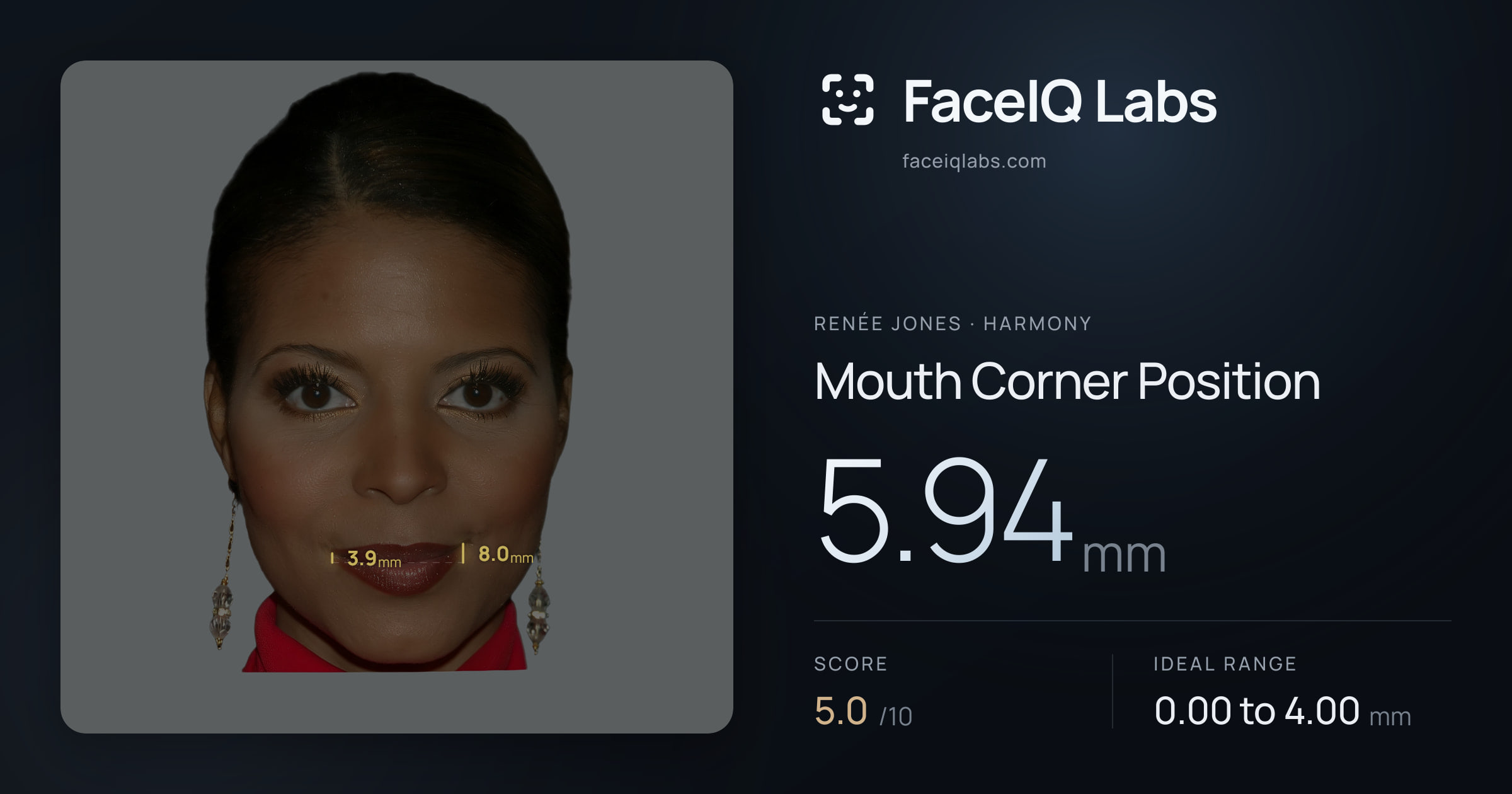 Renée Jones Mouth Corner Position: 5.94mm, drawn on the photo