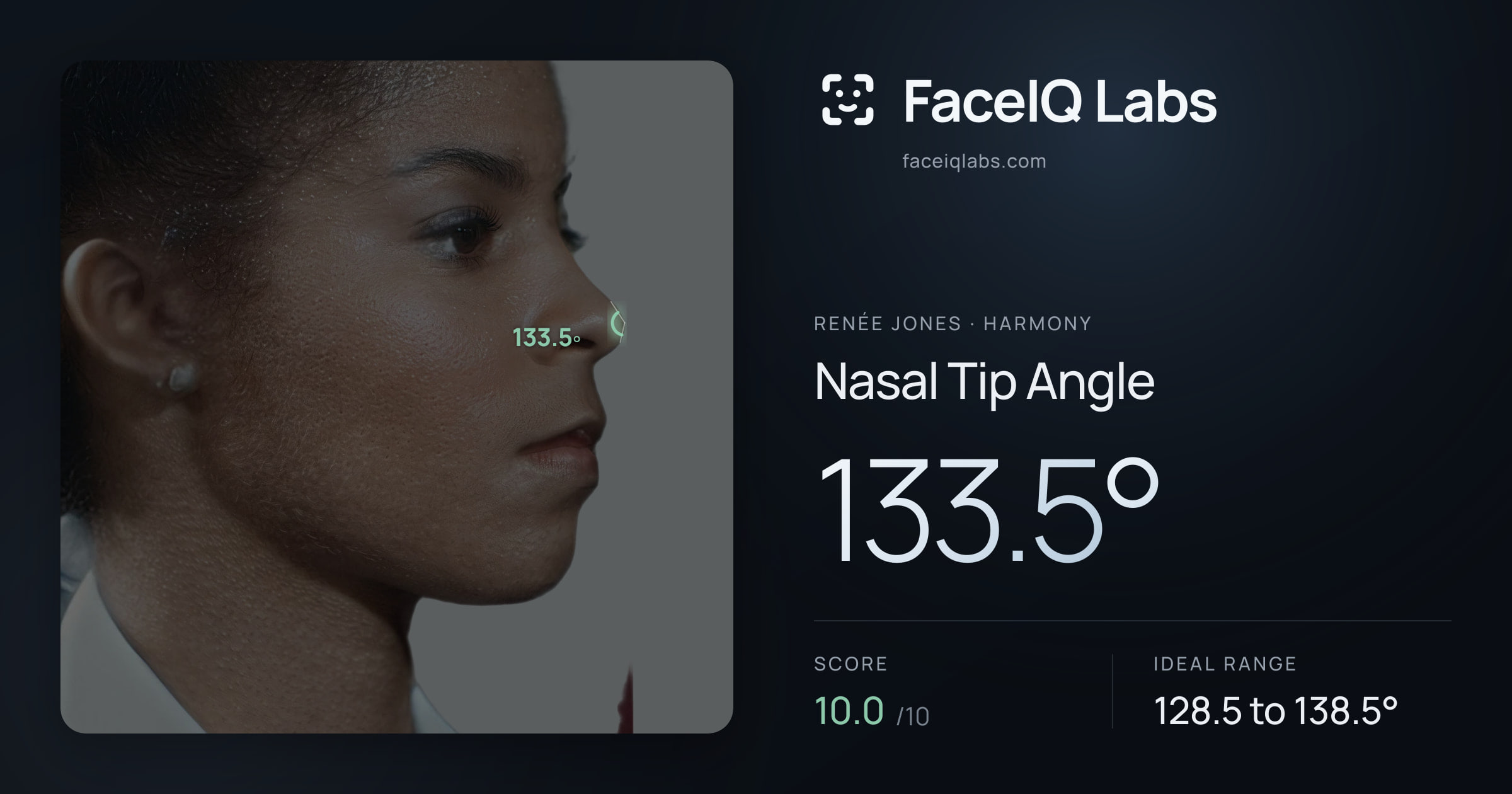 Renée Jones Nasal Tip Angle: 133.5°, drawn on the photo