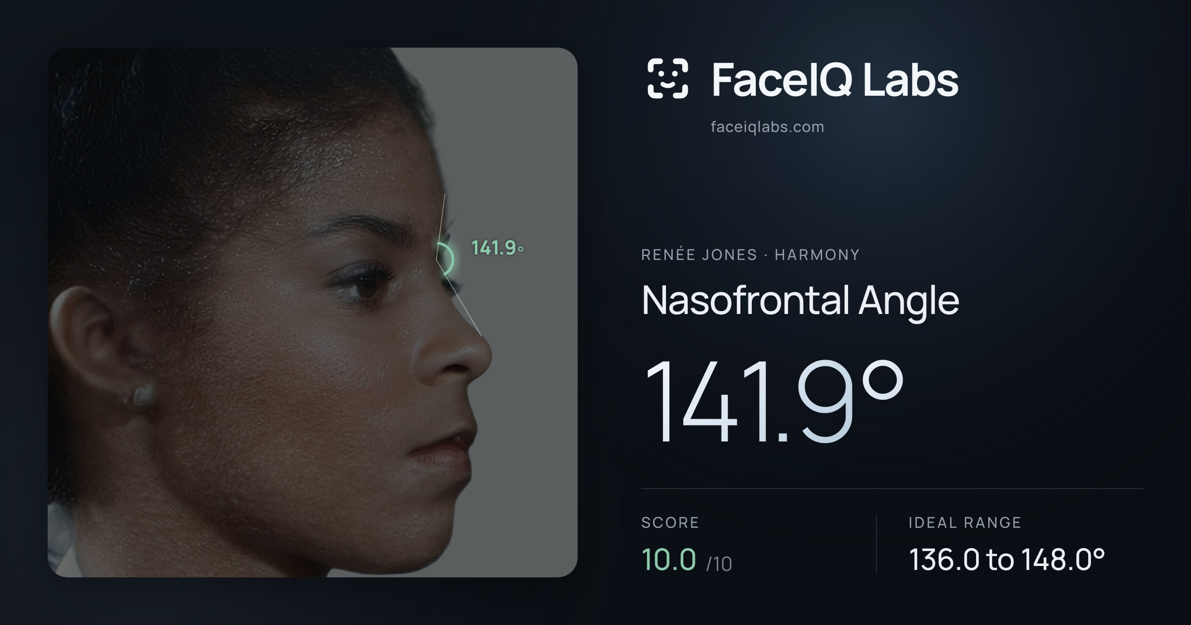 Renée Jones Nasofrontal Angle: 141.9°, drawn on the photo