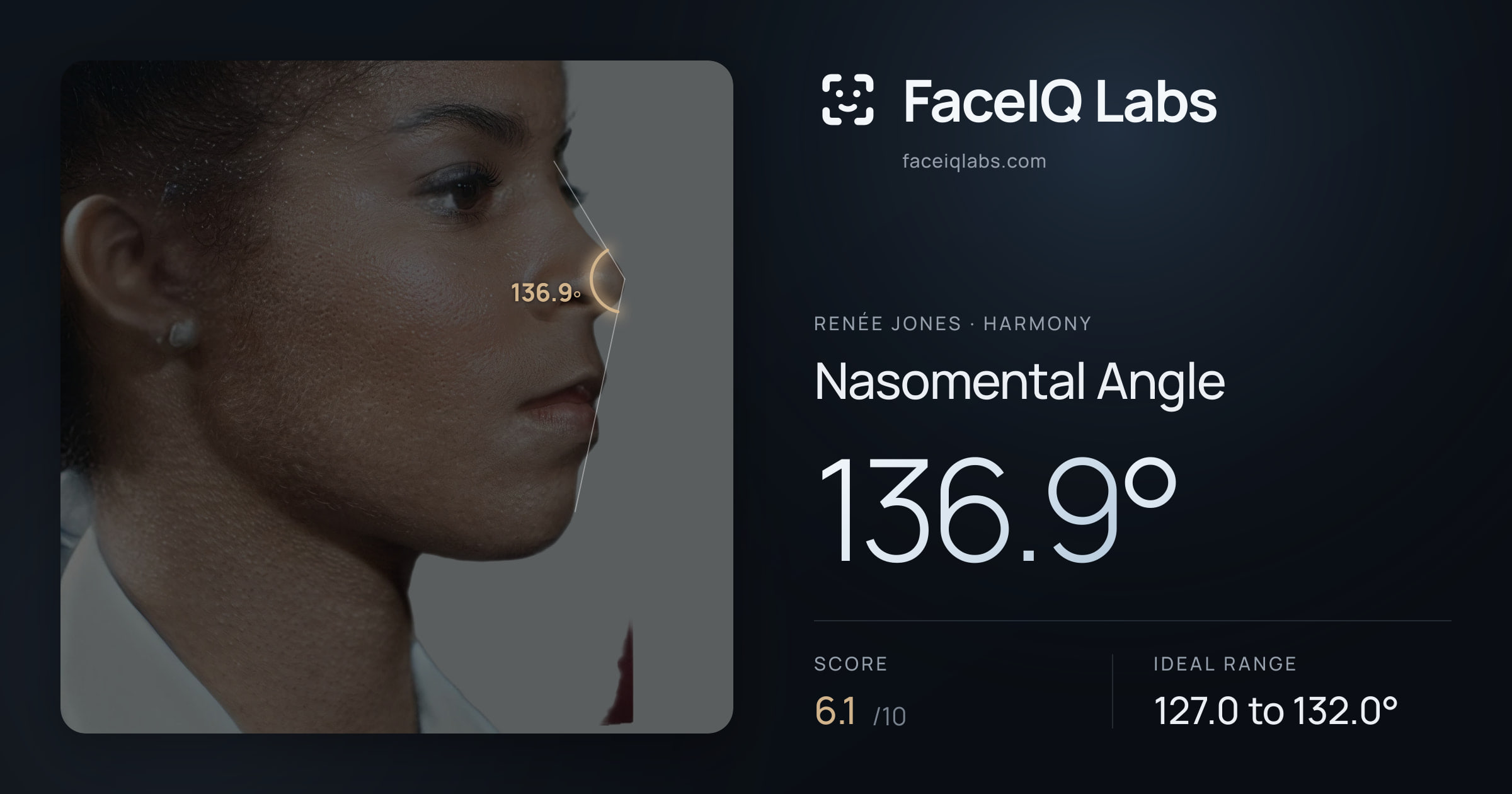 Renée Jones Nasomental Angle: 136.9°, drawn on the photo