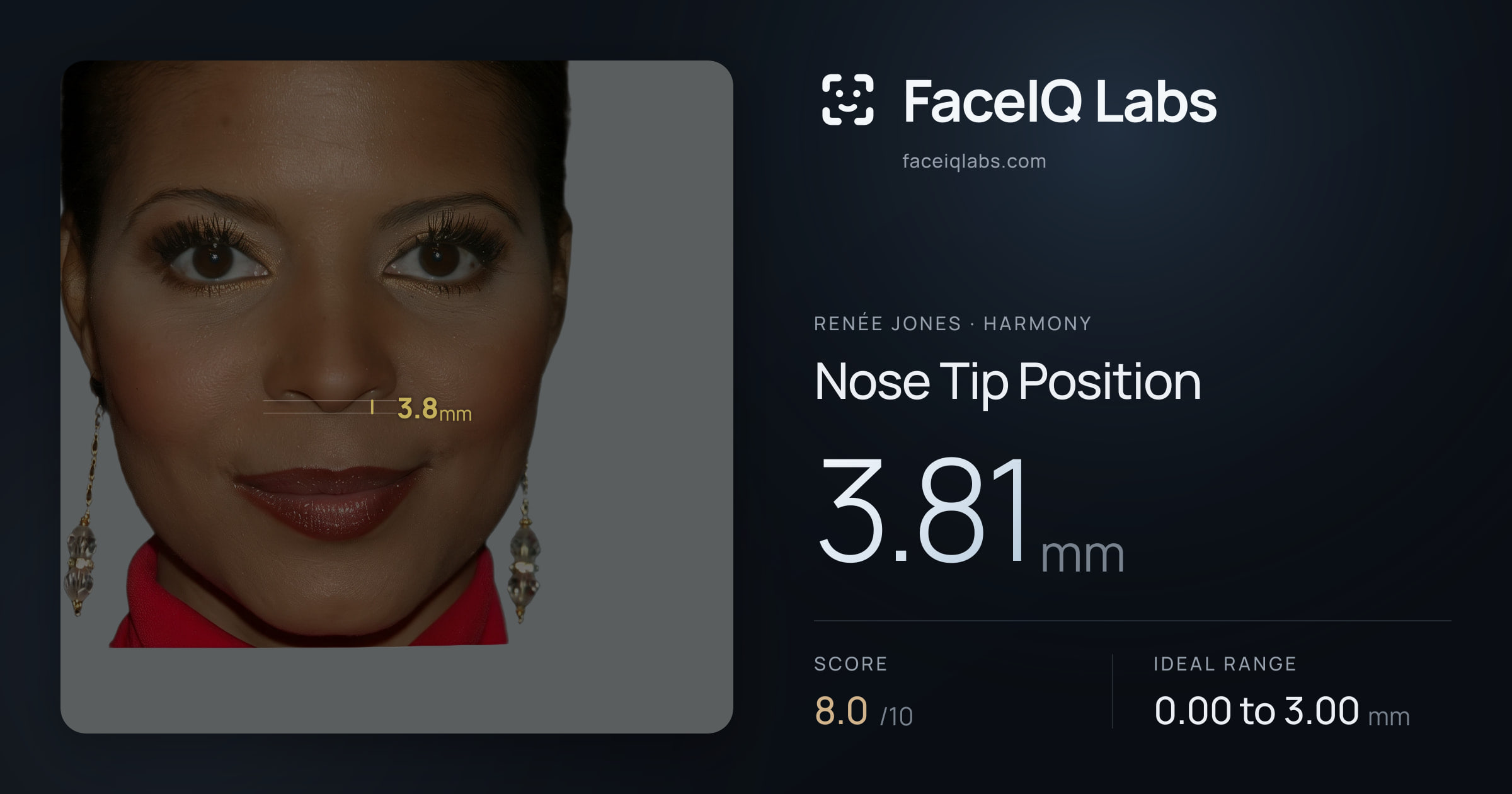 Renée Jones Nose Tip Position: 3.81mm, drawn on the photo