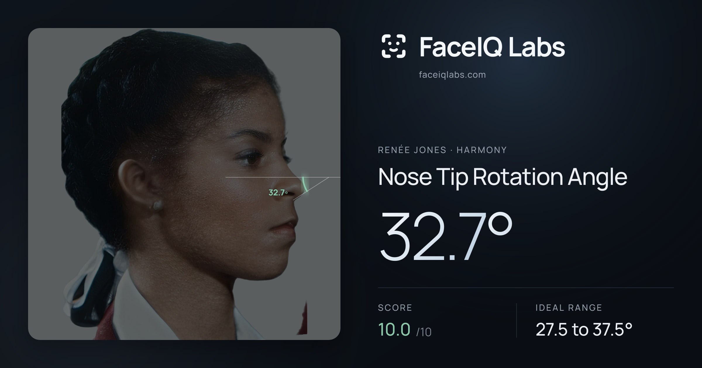 Renée Jones Nose Tip Rotation Angle: 32.7°, drawn on the photo