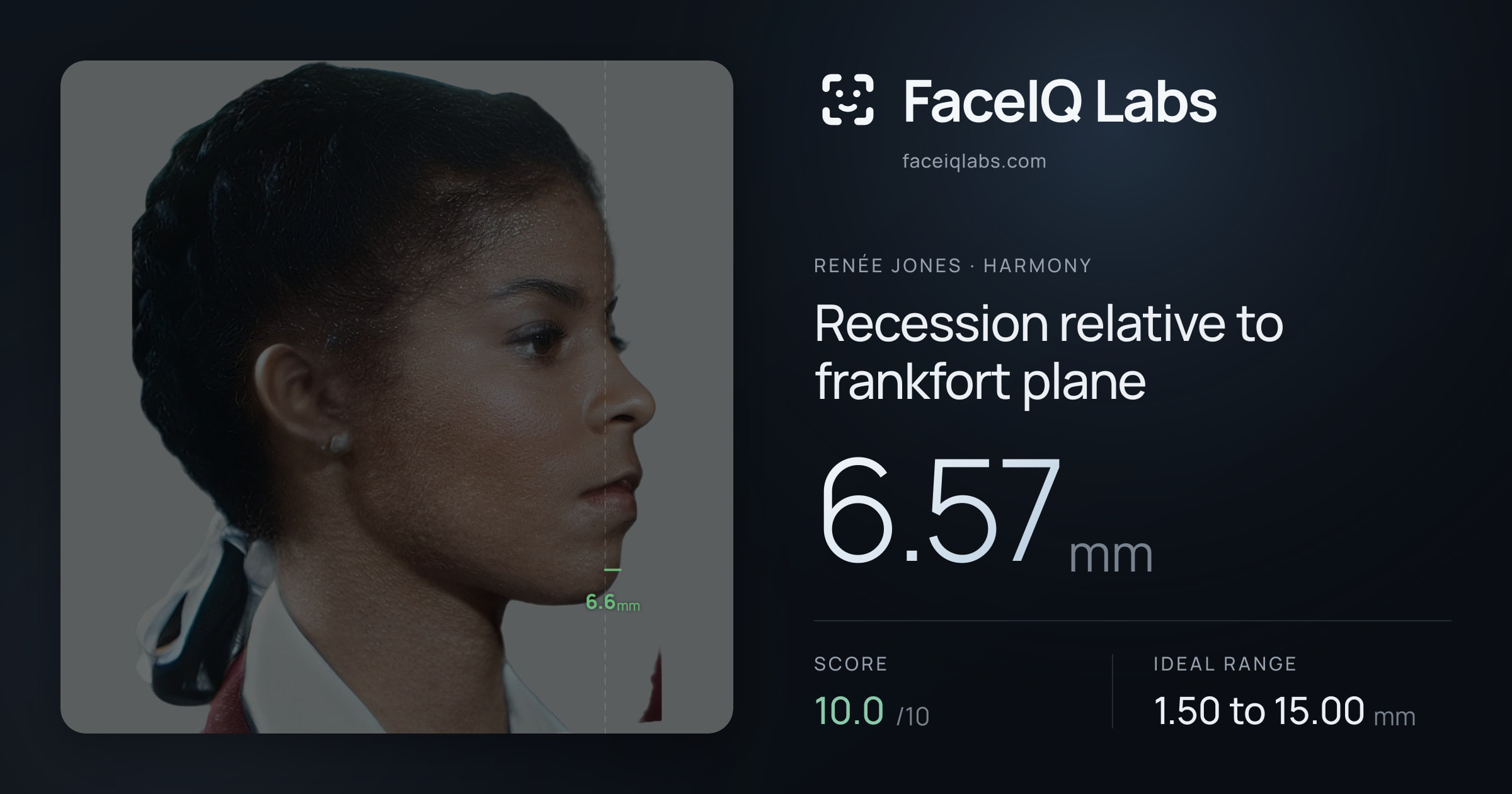 Renée Jones Recession relative to frankfort plane: 6.57mm, drawn on the photo